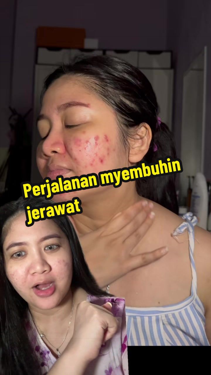 @Nola Hariadi