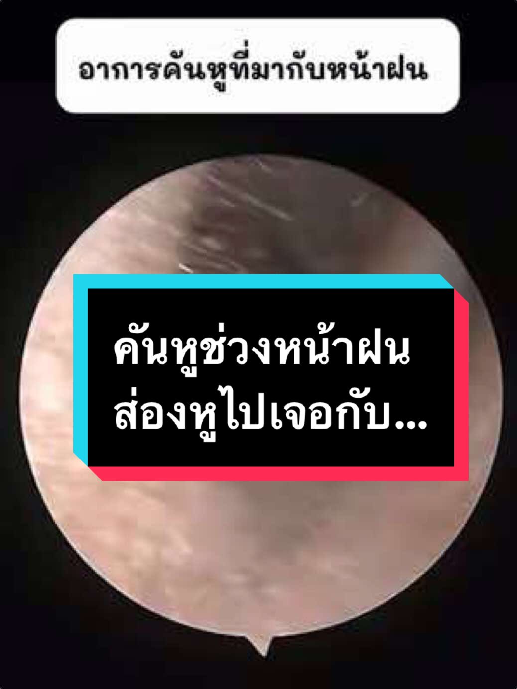 @คลินิกหมอณัฐธยาน์ หู คอ จมูก