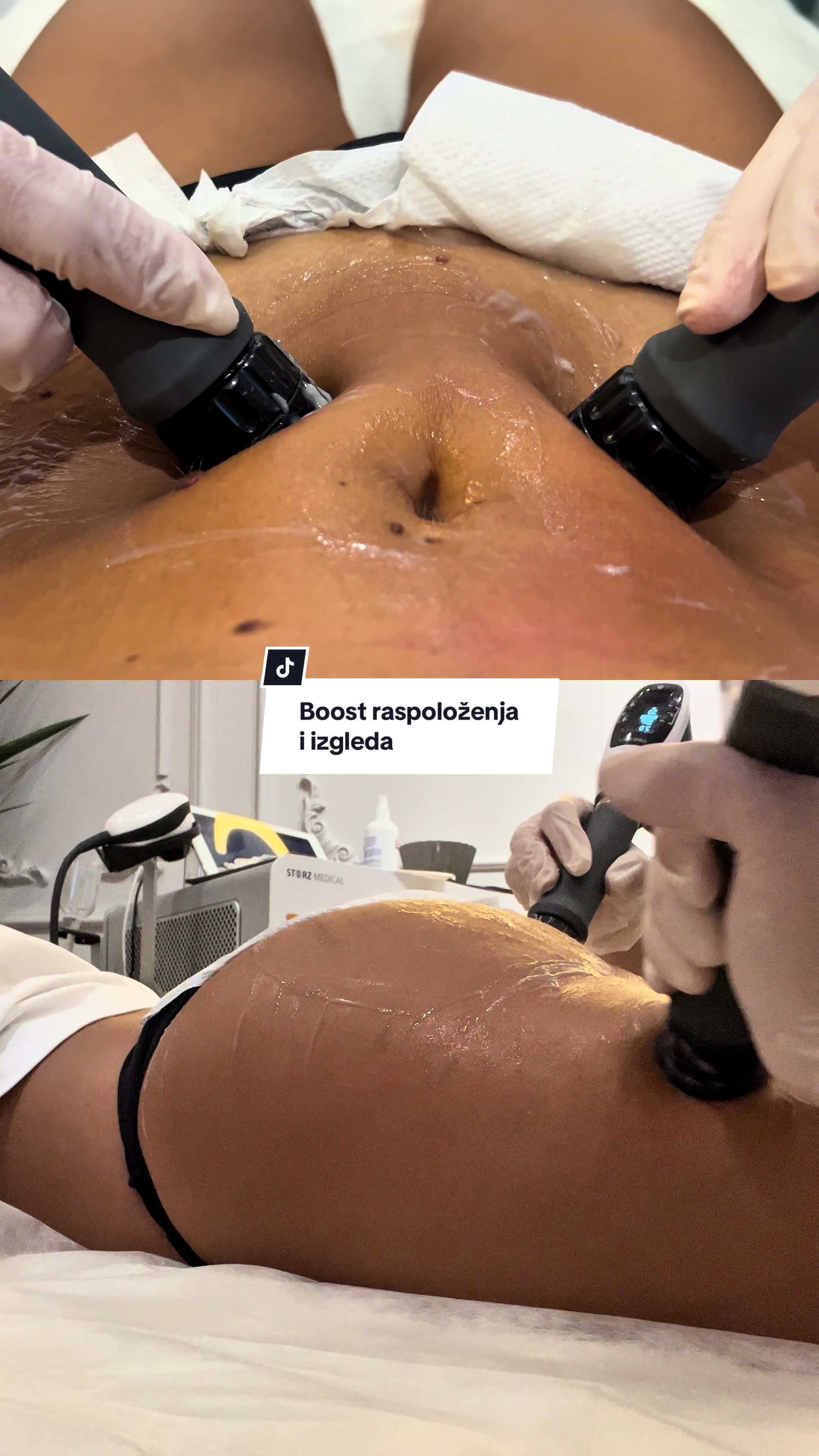 @Spektakl od žene