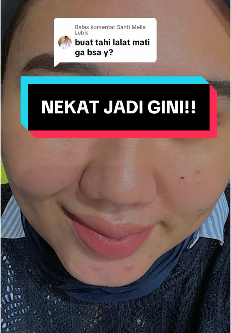@Penghilangtahilalat.kaq.ay