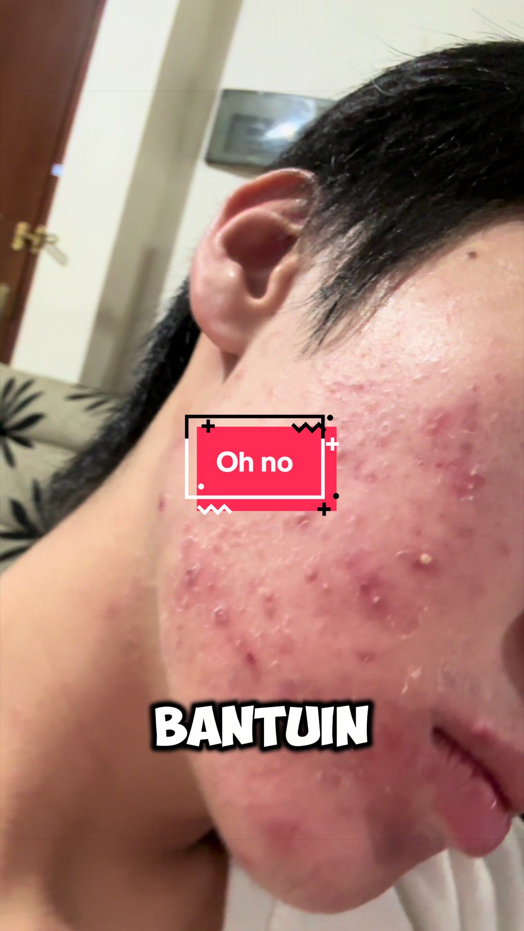 @Mau kulit sehat