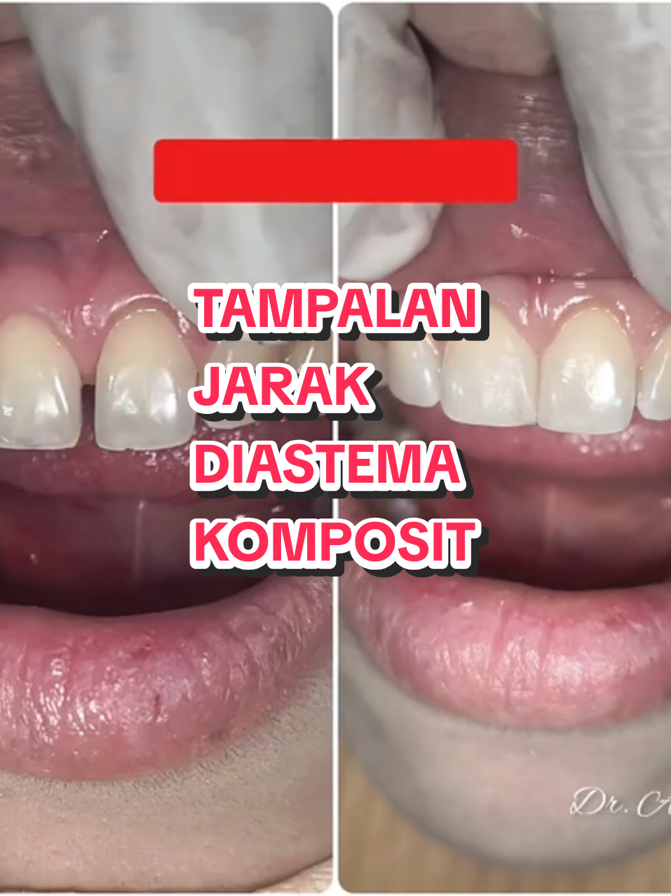 @Dr. Azila