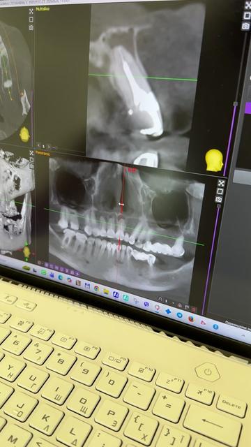 @Стоматологія ДрогобичMaxDental