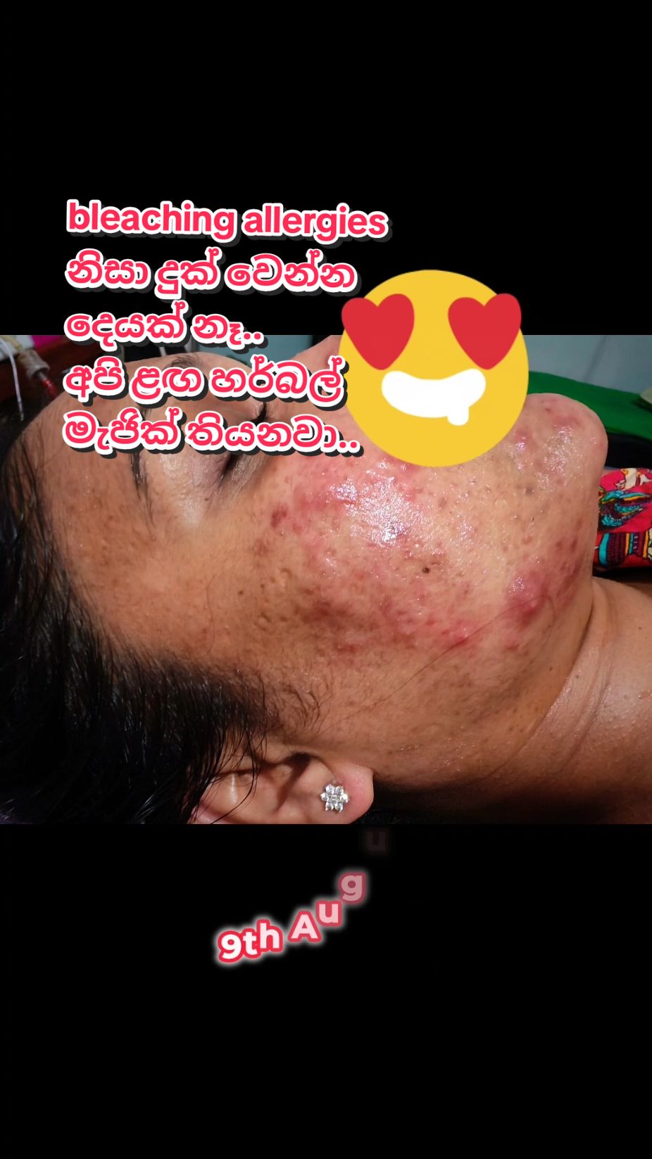 @Anjula Liyanage