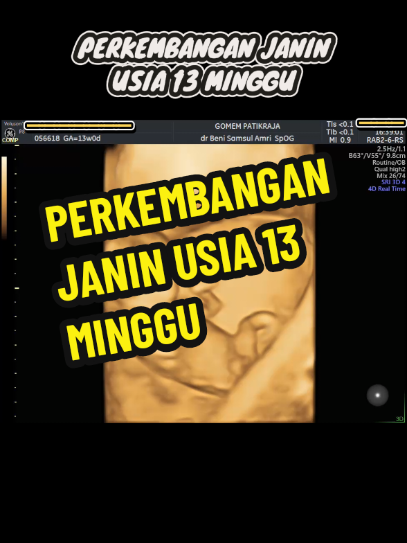 @USG 4D PURWOKERTO