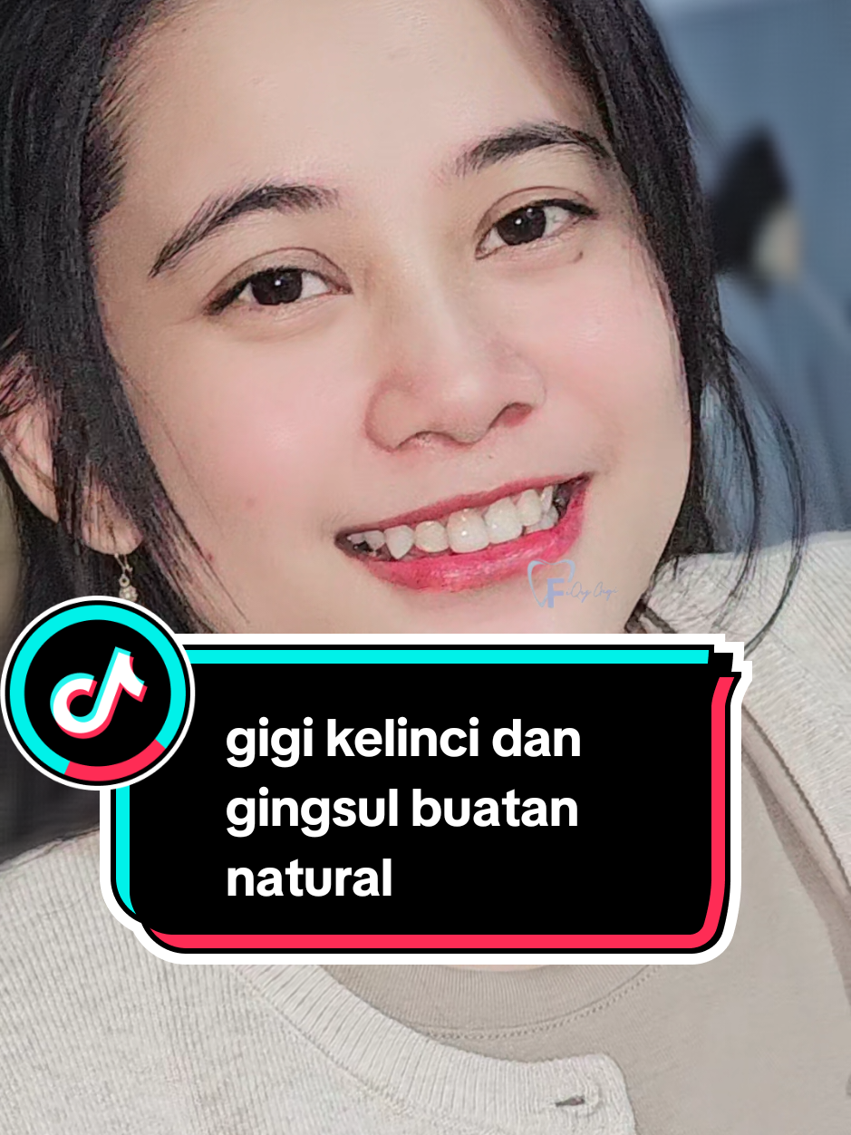 @Fiqygigi