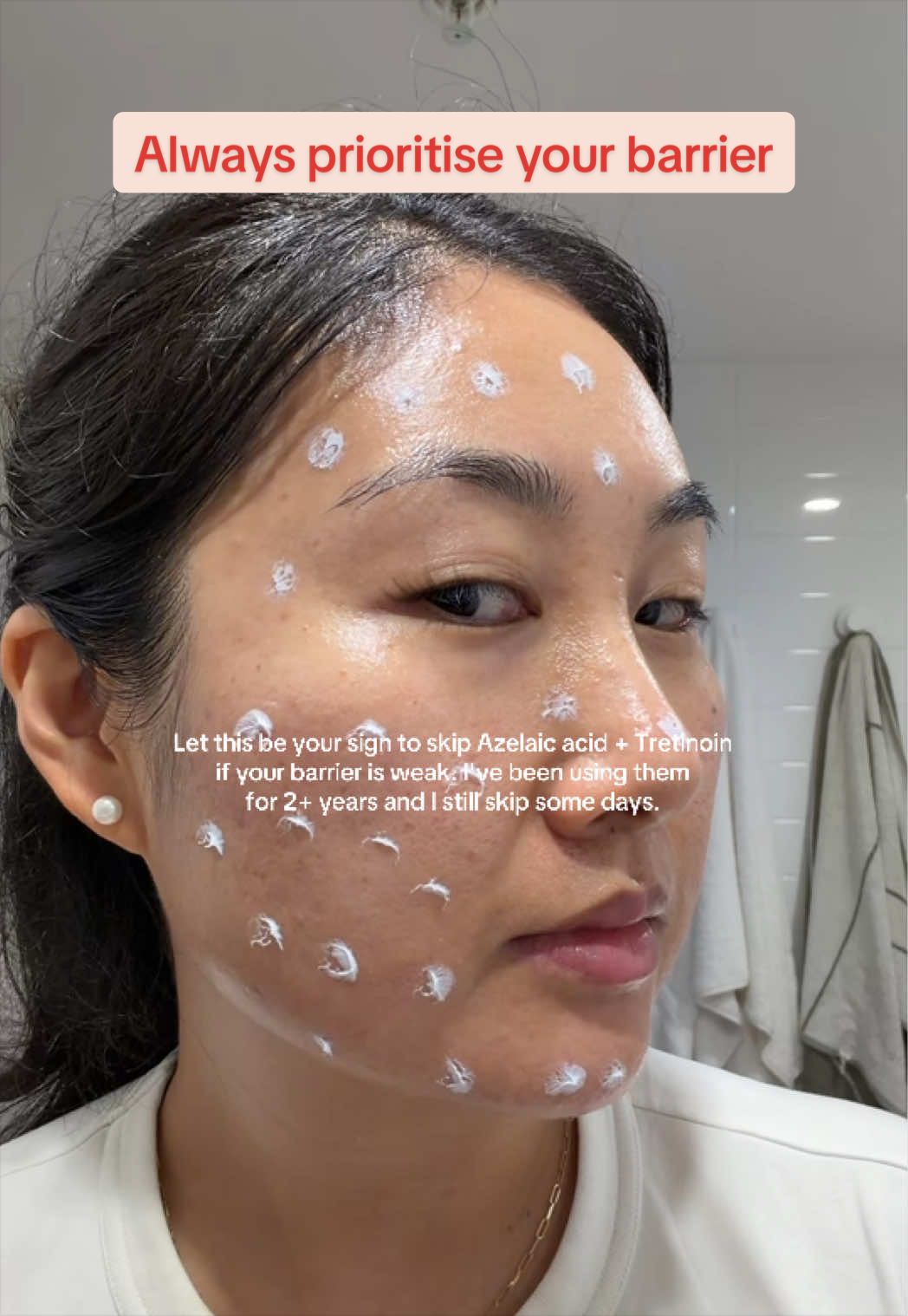 @Lisa | acne → clear skin