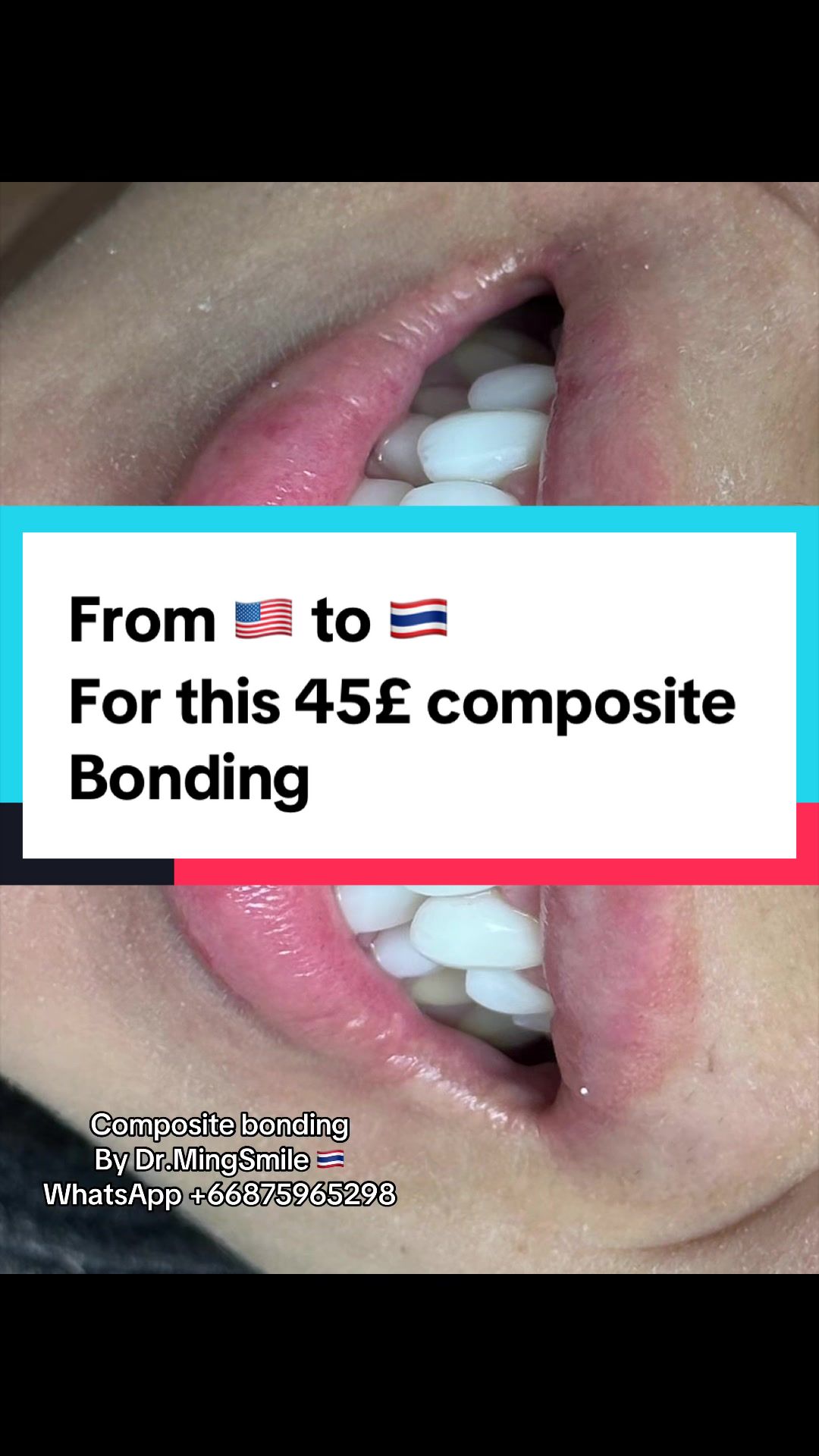 @Dr.MingSmile &hearts;️ Bangkok&Krabi