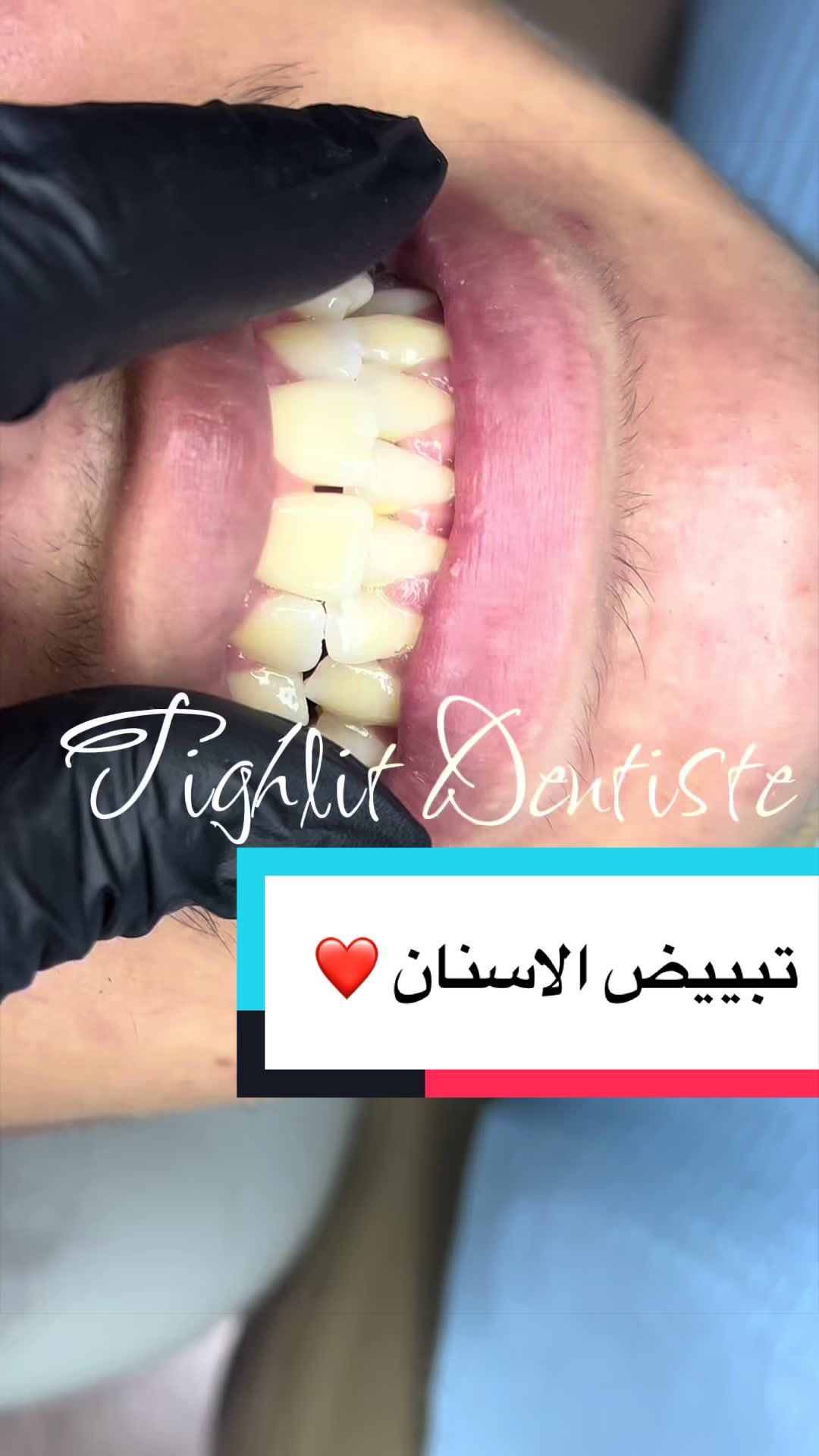 @tighlit_dentiste🦷