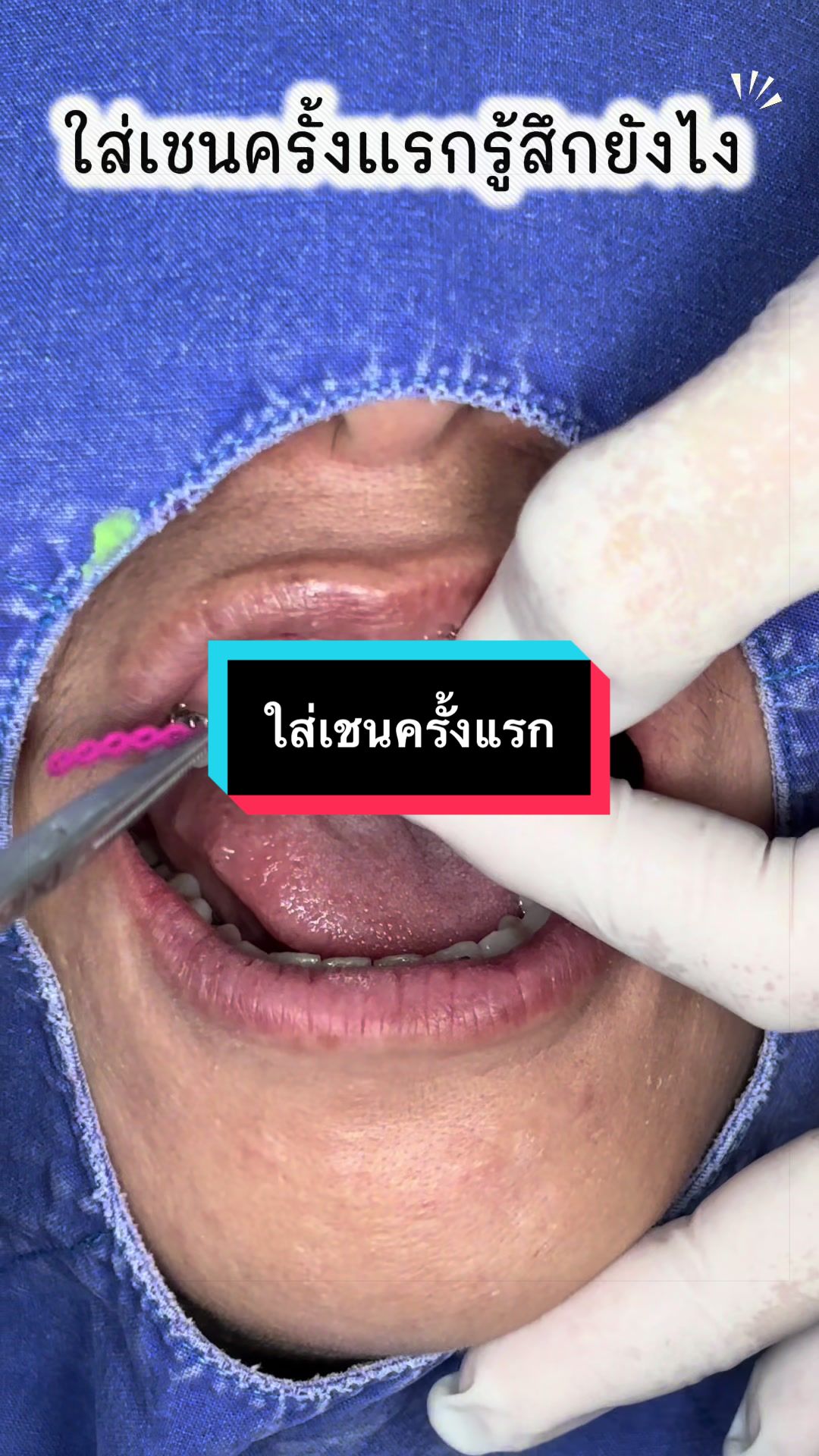 @ซอฟแอนด์สไมล์ลาดกระบัง