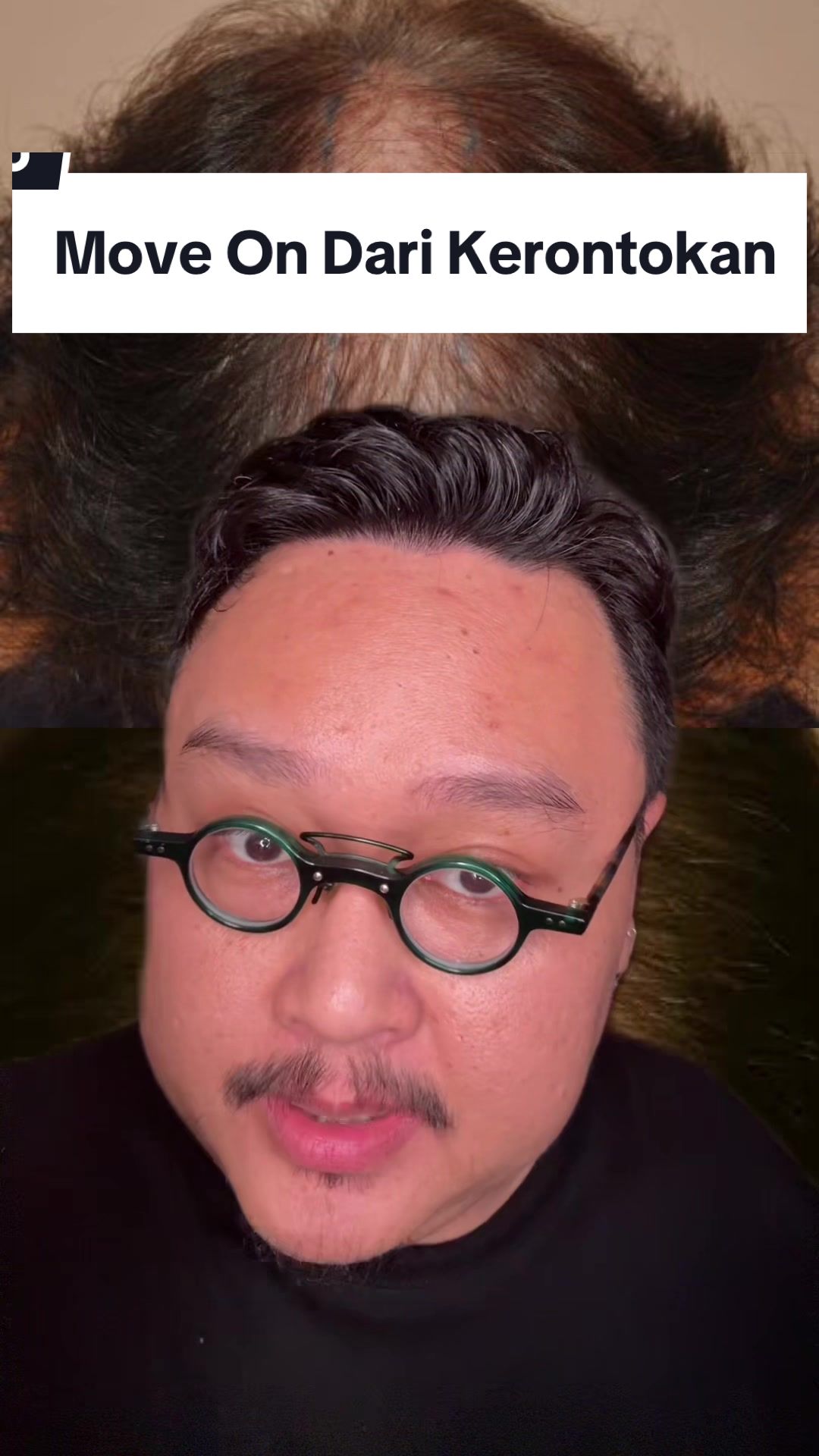 @Ali | @HungryForSkincare