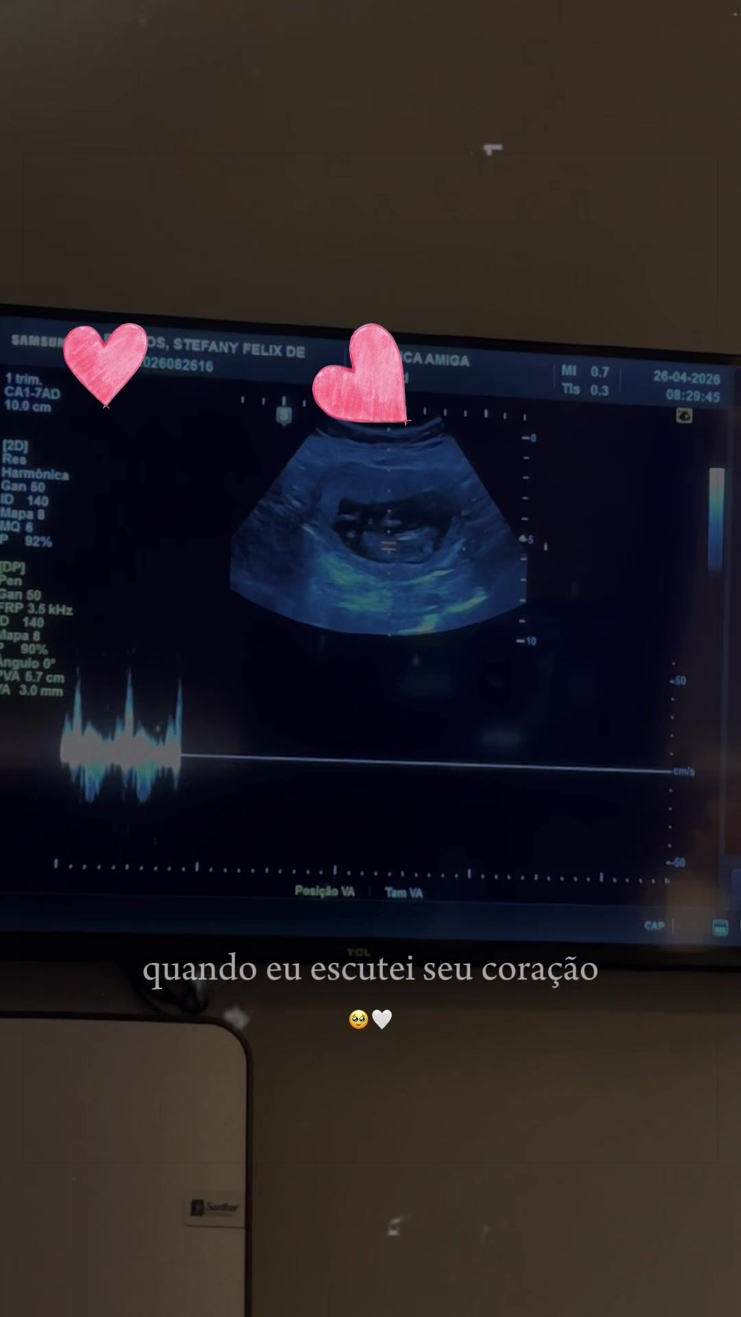 @Stefany Felix
