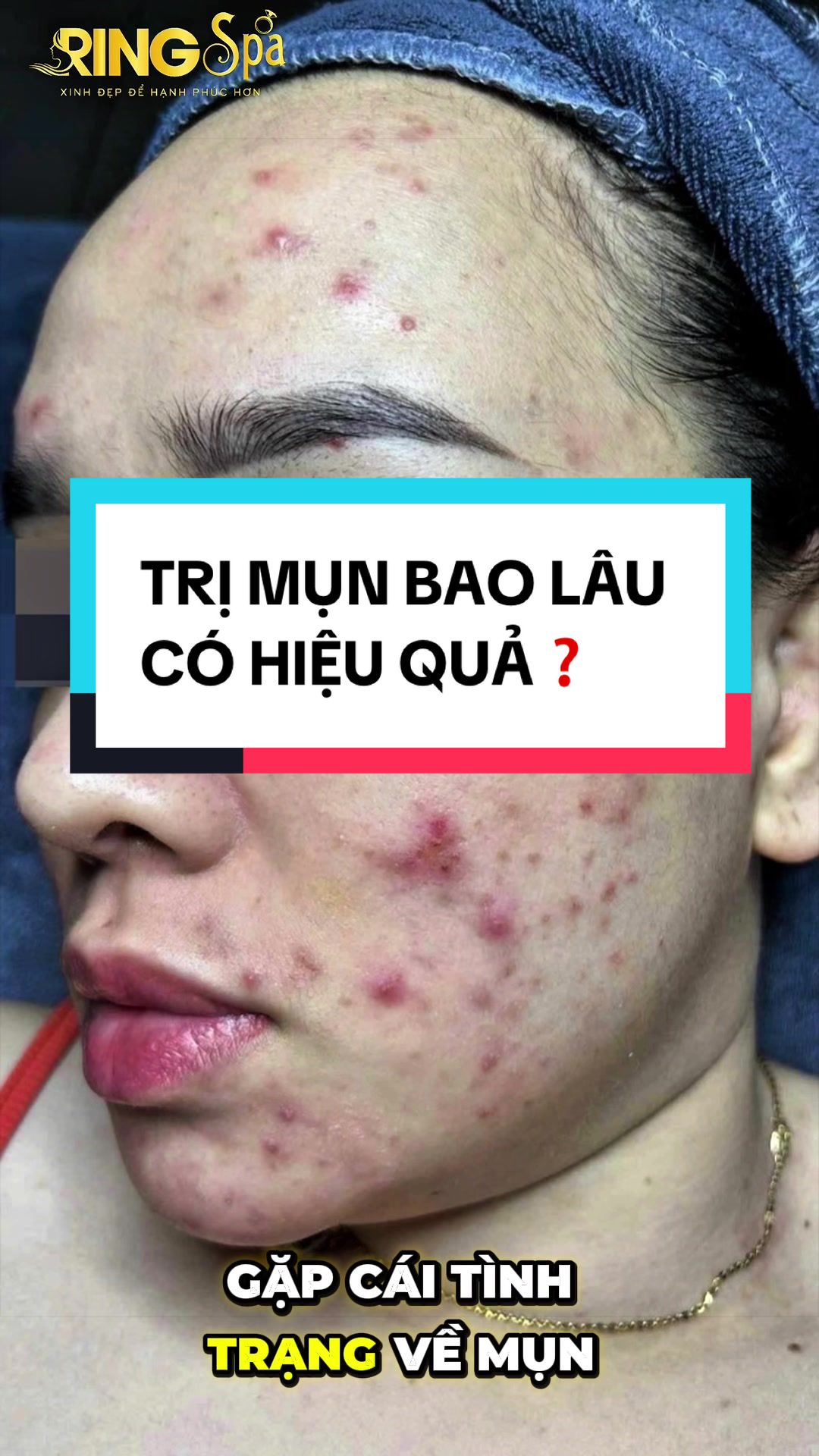@Ring_Spa