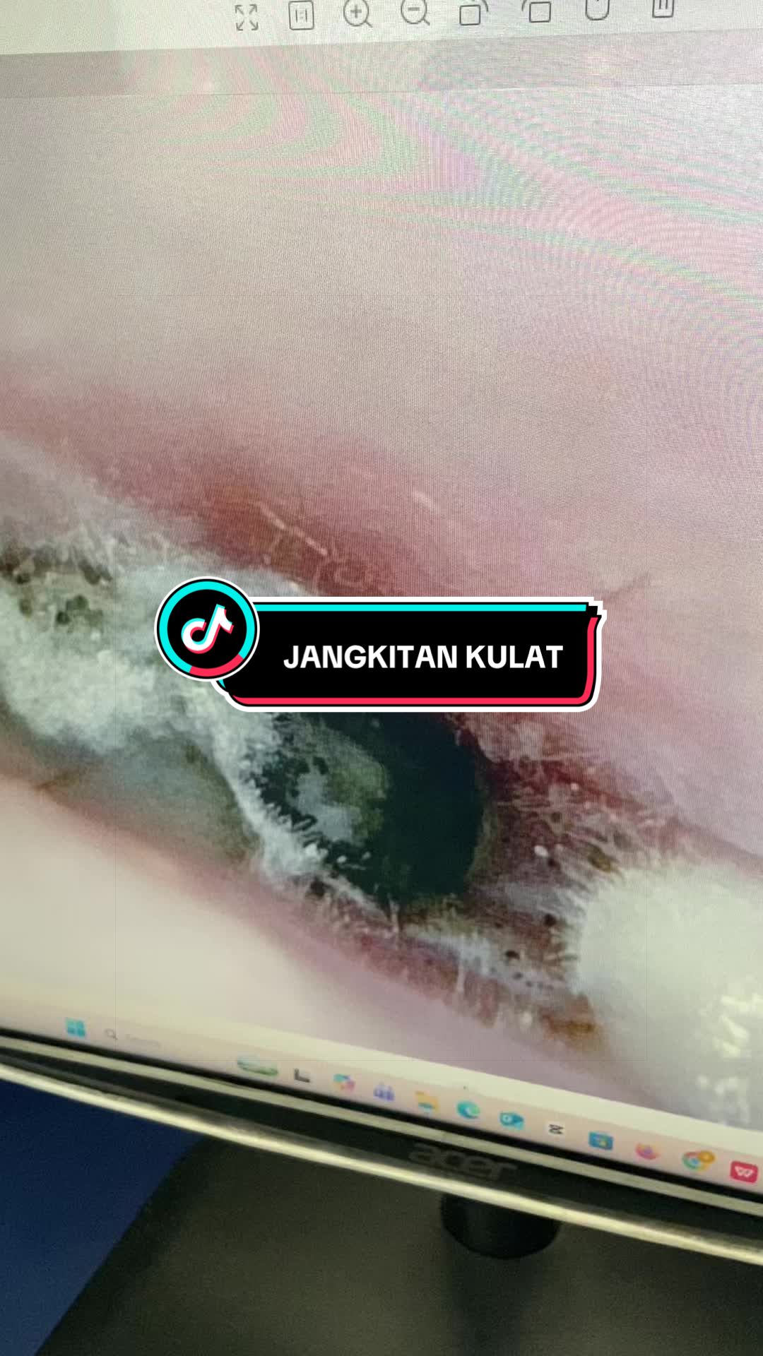 @Klinik Aqwa Care
