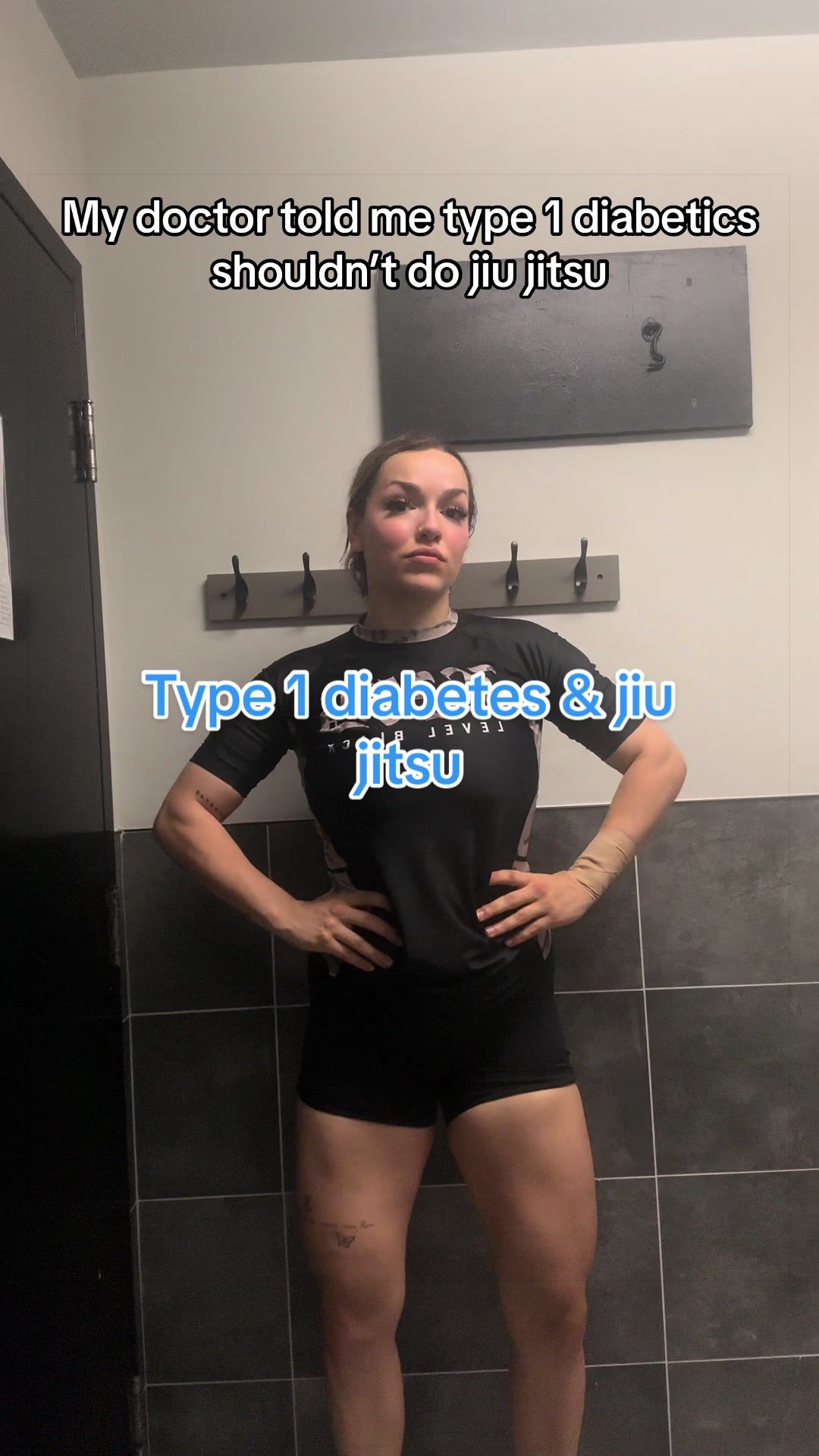 @TYPE 1 DEEABETES