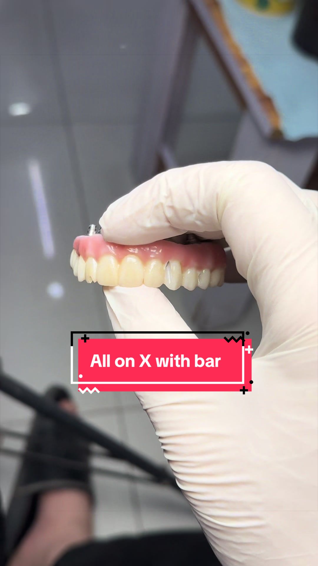 @Dr RahmatullahDental surgeon