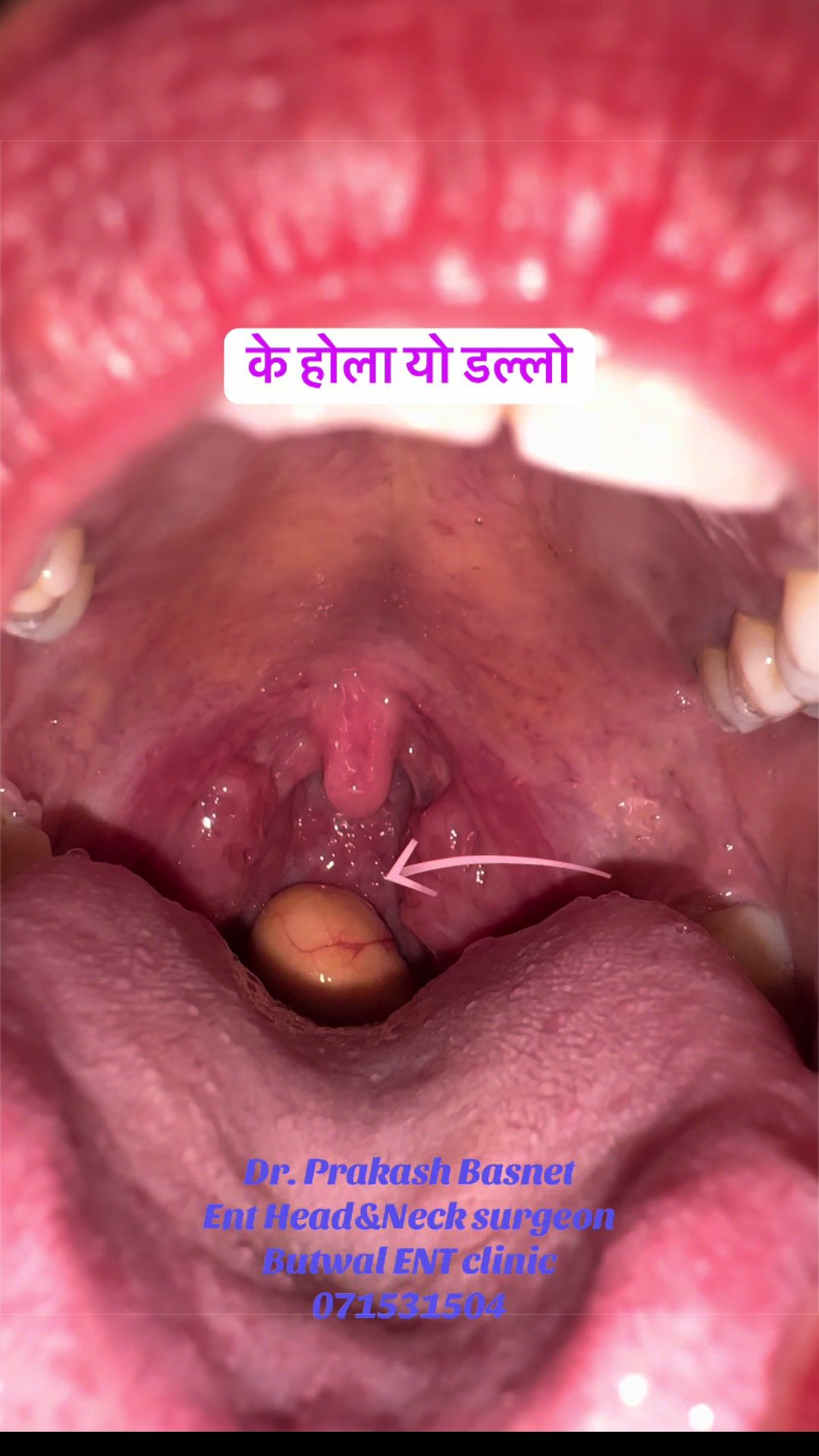 @DrPrakash Basnet