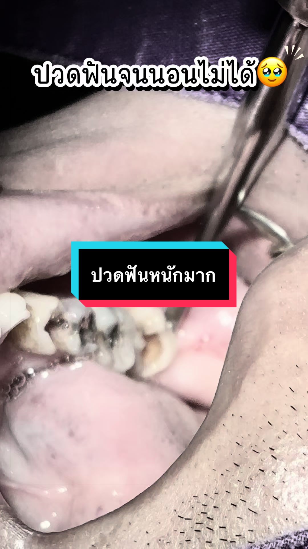 @ซอฟแอนด์สไมล์ลาดกระบัง