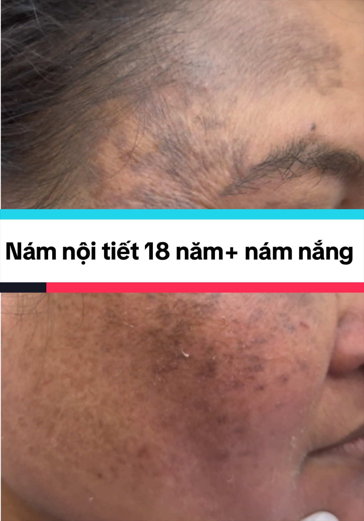 @Ho&agrave;ng Anh N Beauty