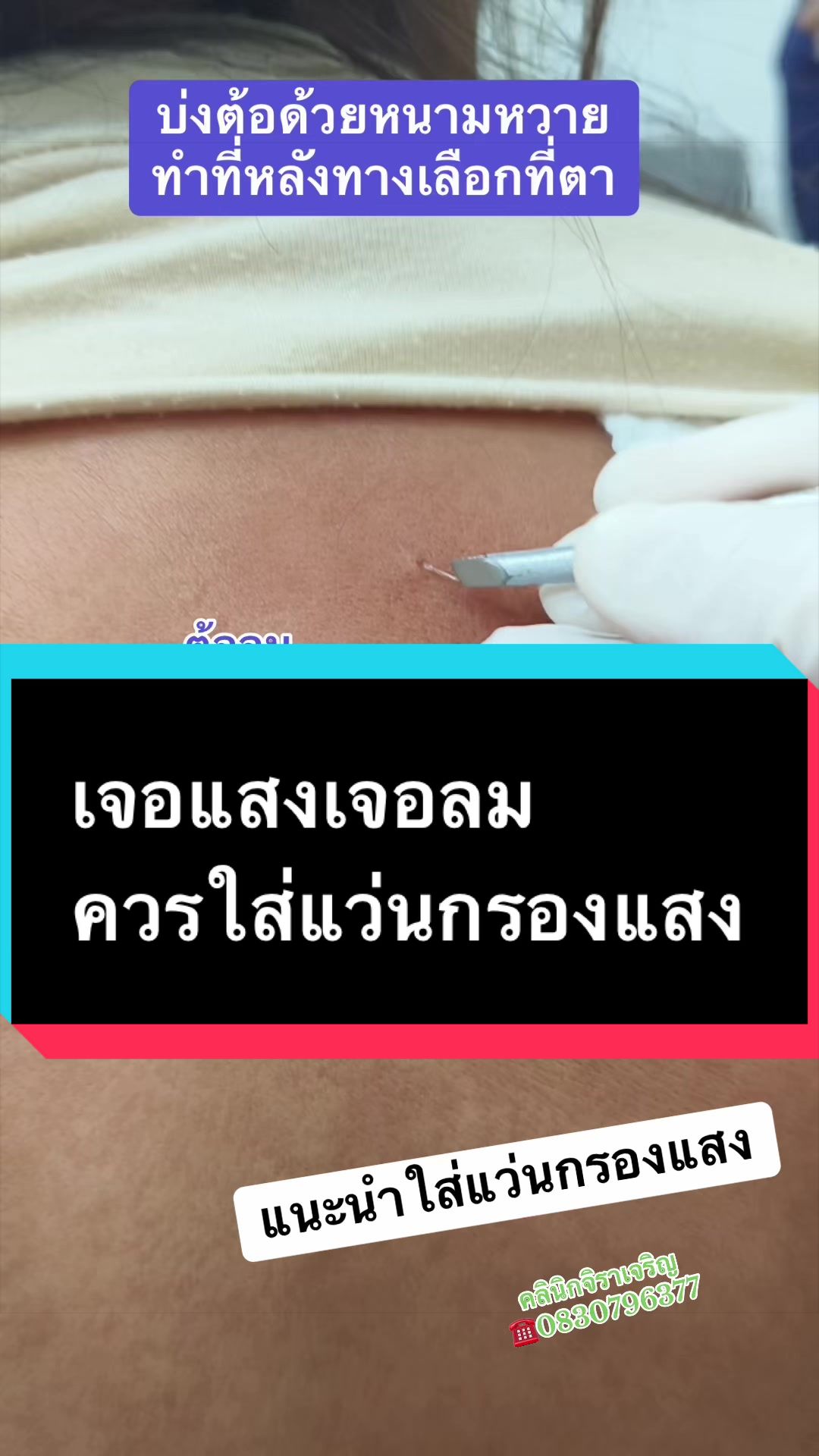 @หมอเชอร์รี่