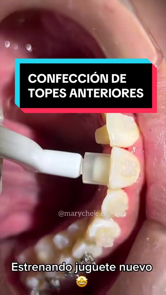 @Od. Marilyn Chejade L. 😷🦷