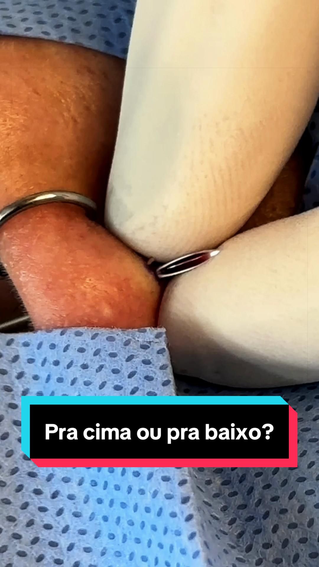 @Igor Sudano