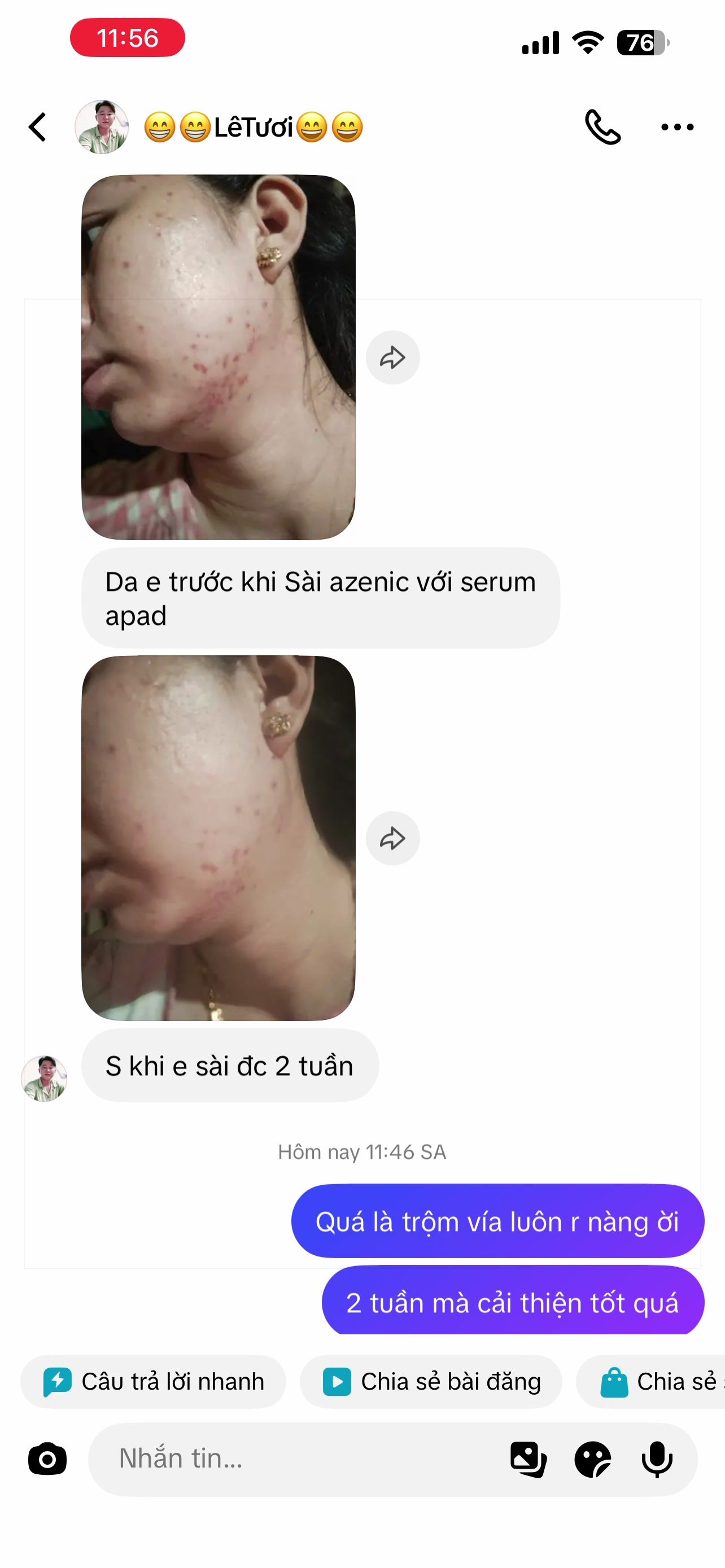 @Thảo NT Skincare