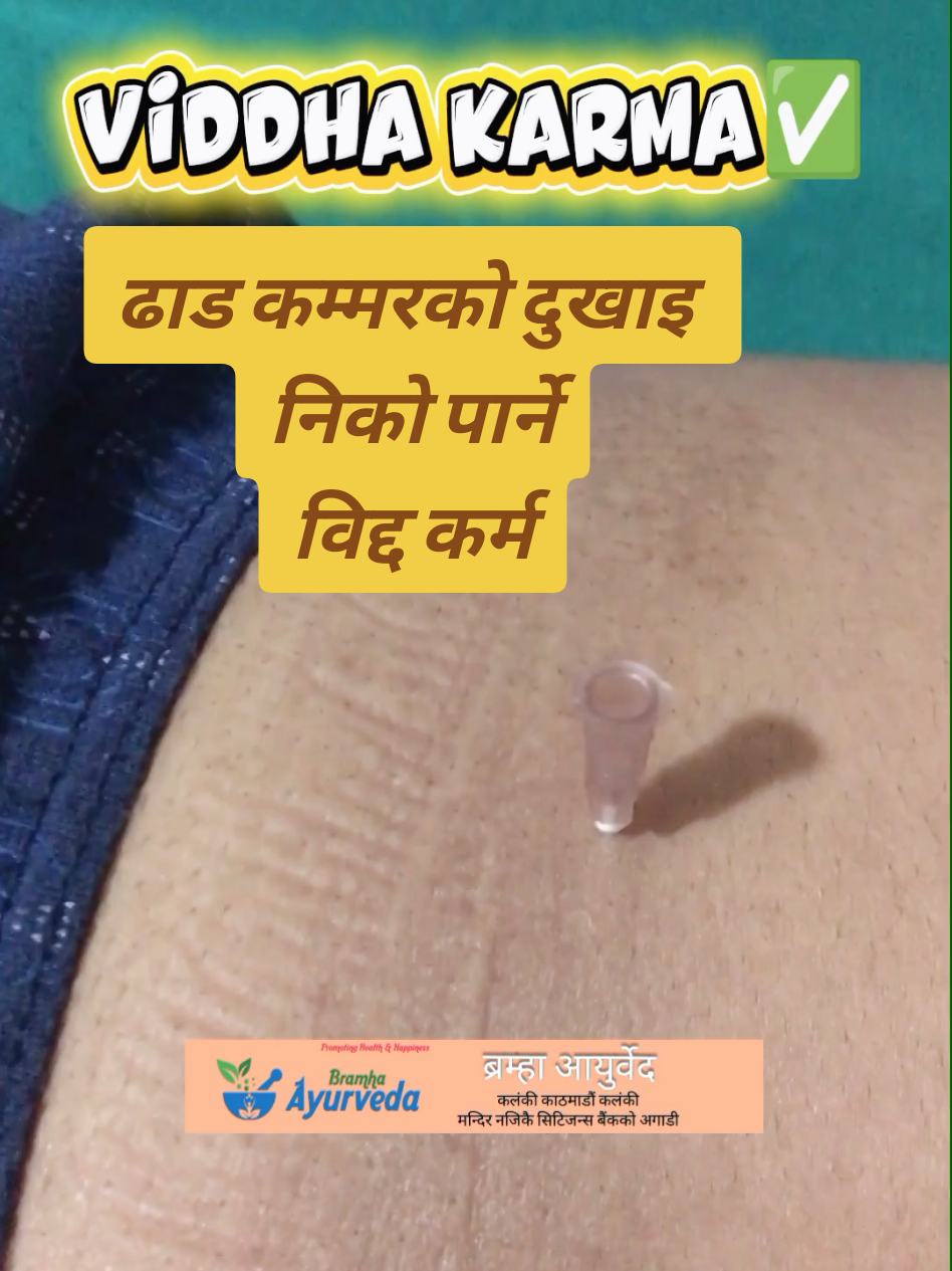@Bramha Ayurveda