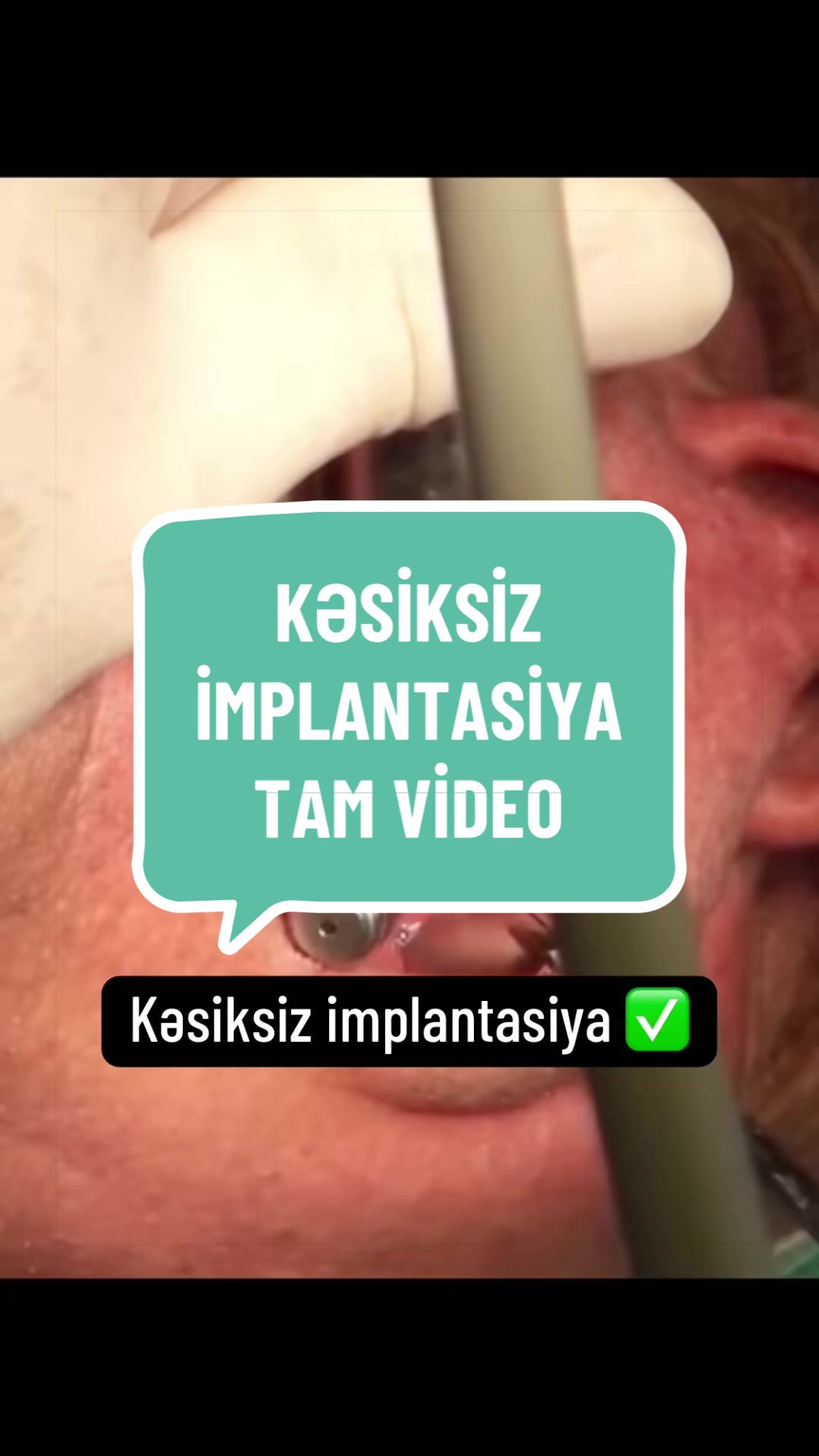 @Stomatoloq.Cavid.Qurbanov