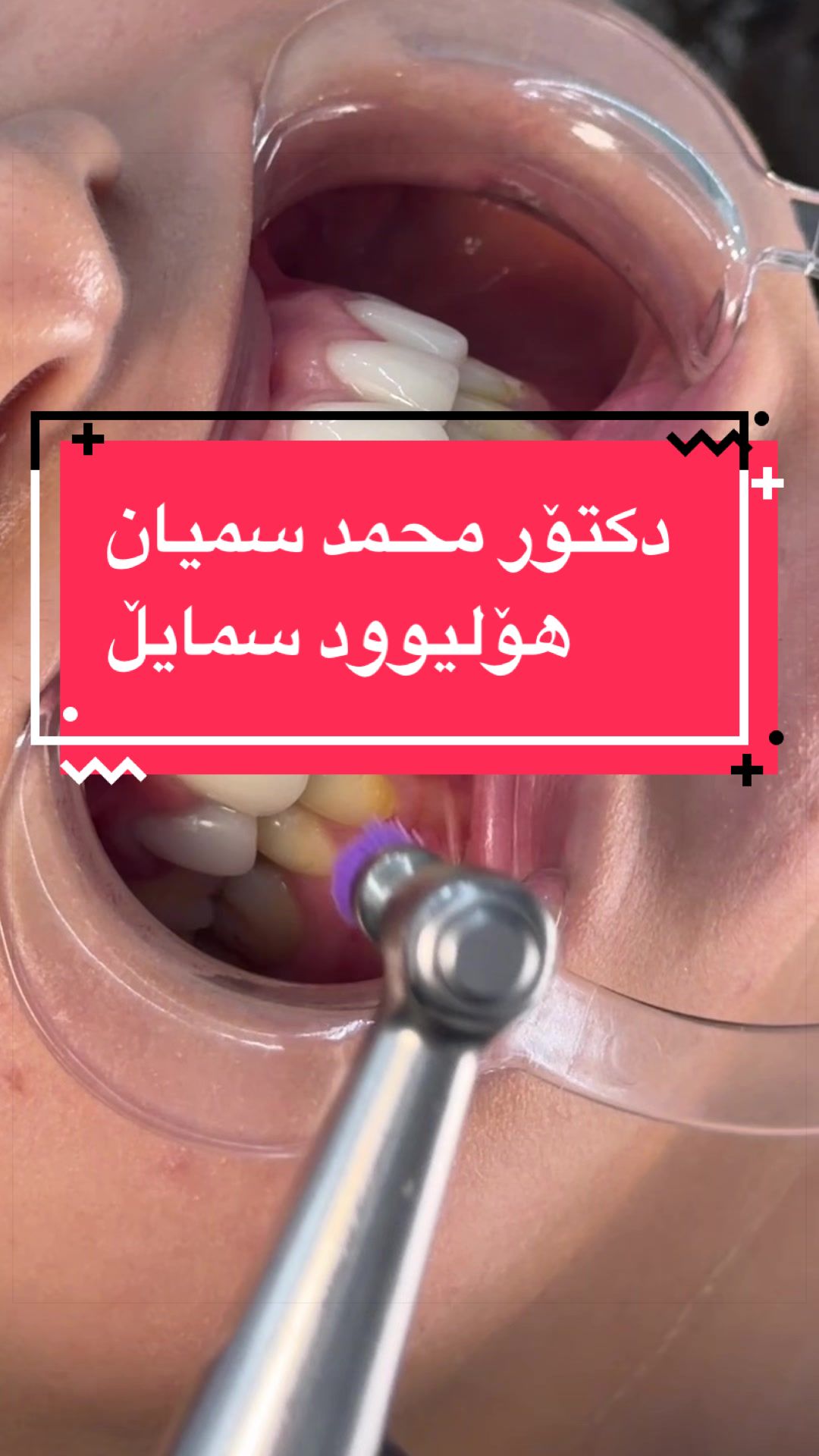 @Dr.Mohamed Samyan