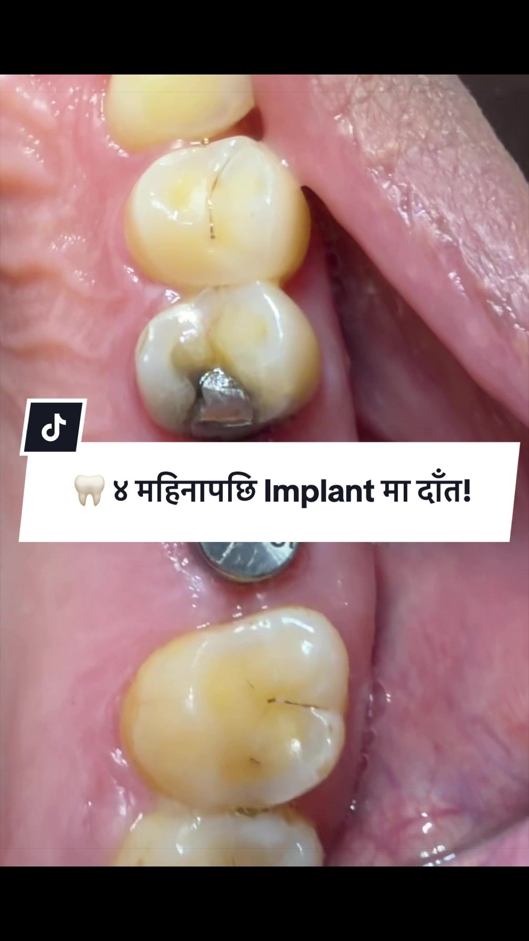 @Smile Engineer Dr Bidhan
