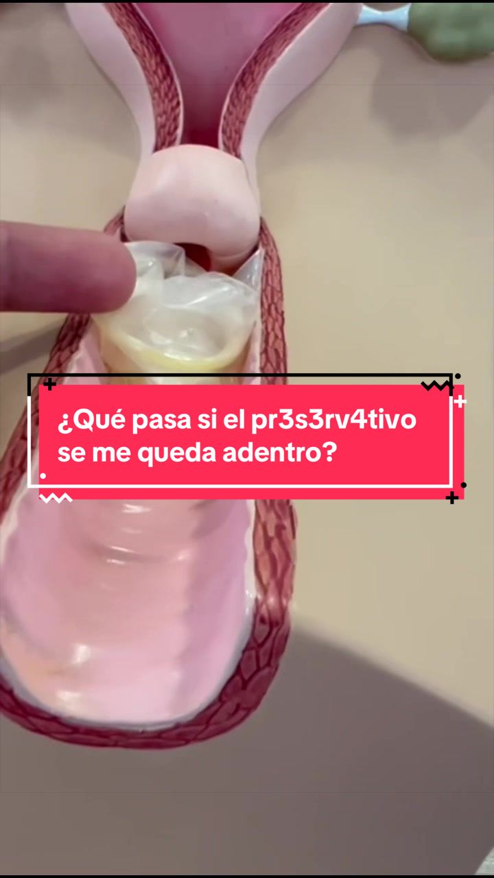 @Dra. Verónica Reyes Ginecóloga