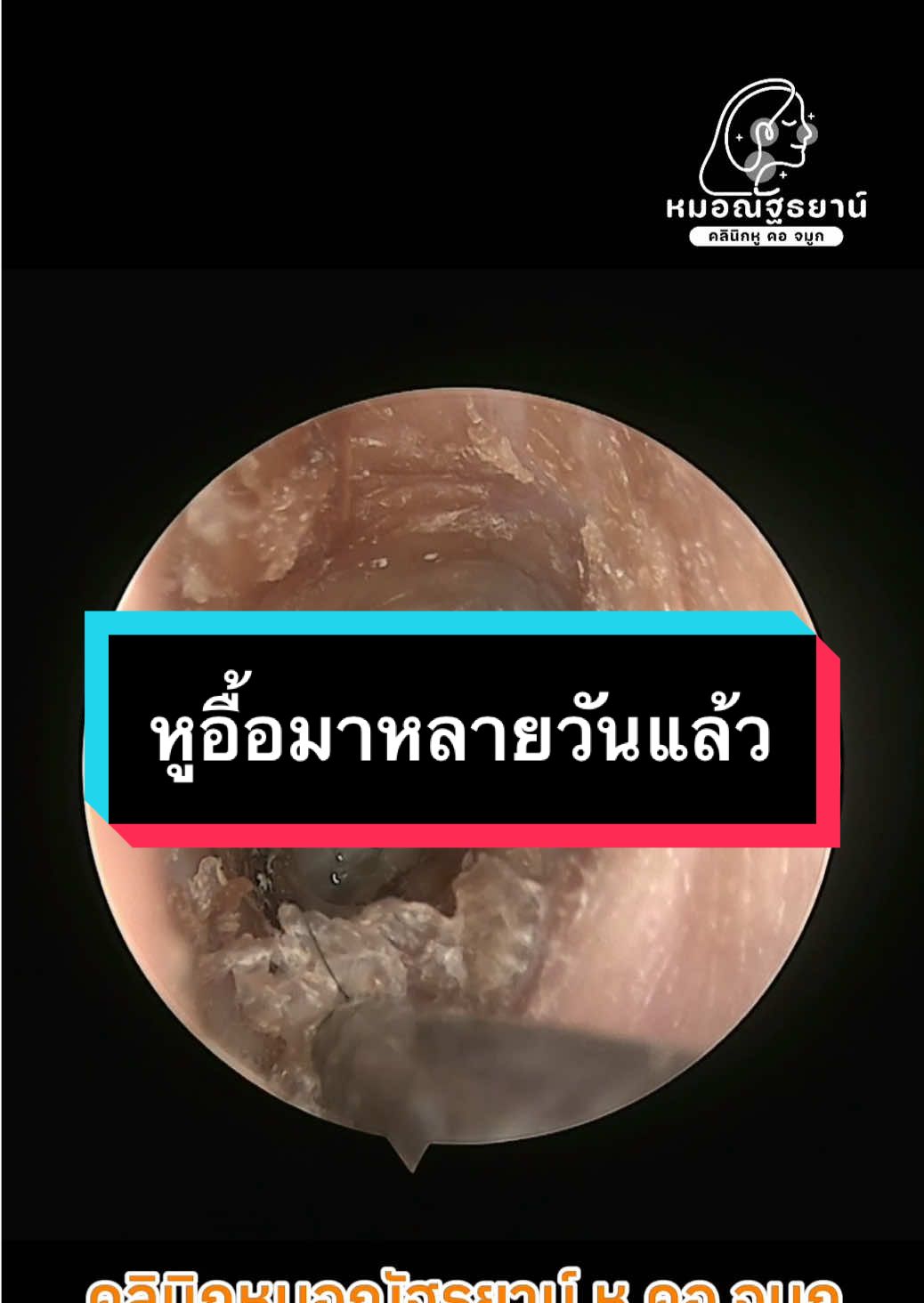 @คลินิกหมอณัฐธยาน์ หู คอ จมูก