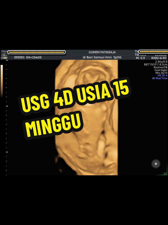 @USG 4D PURWOKERTO