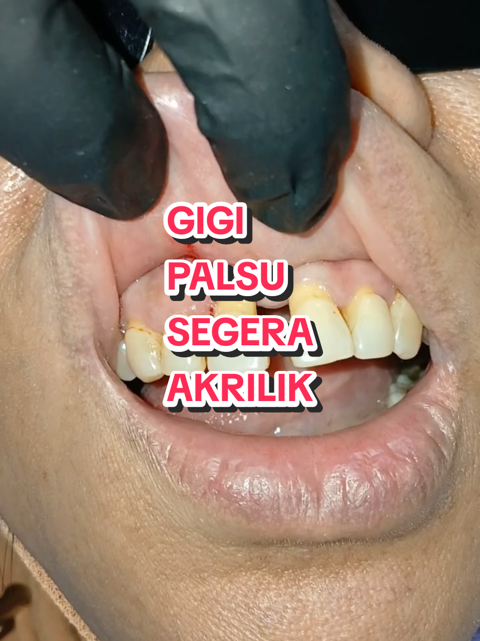 @Dr. Azila