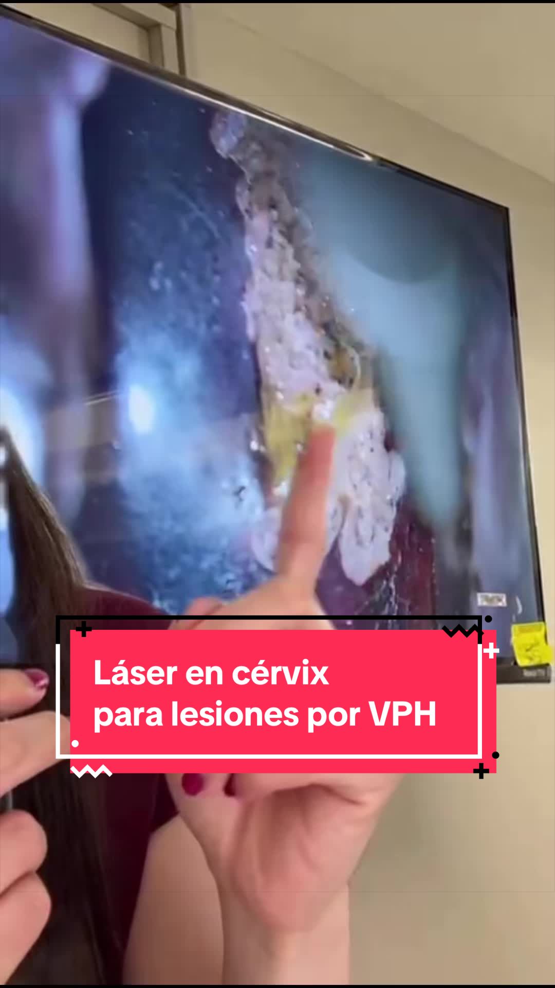 @Dra. Verónica Reyes Ginecóloga