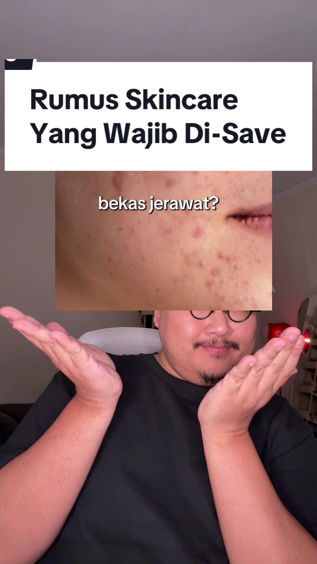 @Ali | @HungryForSkincare