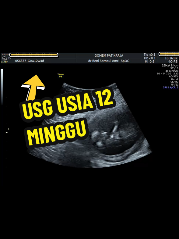 @USG 4D PURWOKERTO