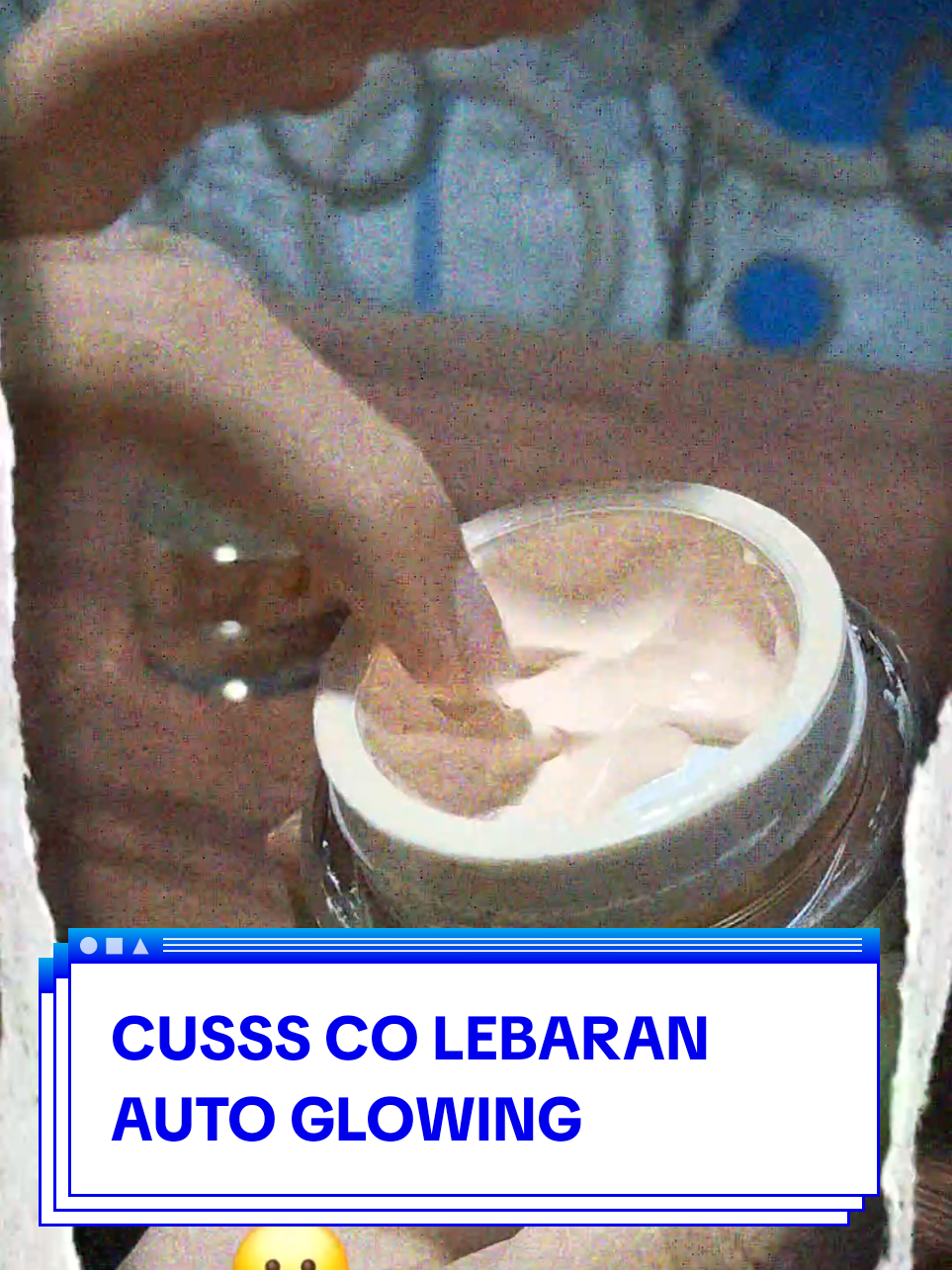 @𝐉j-cortis