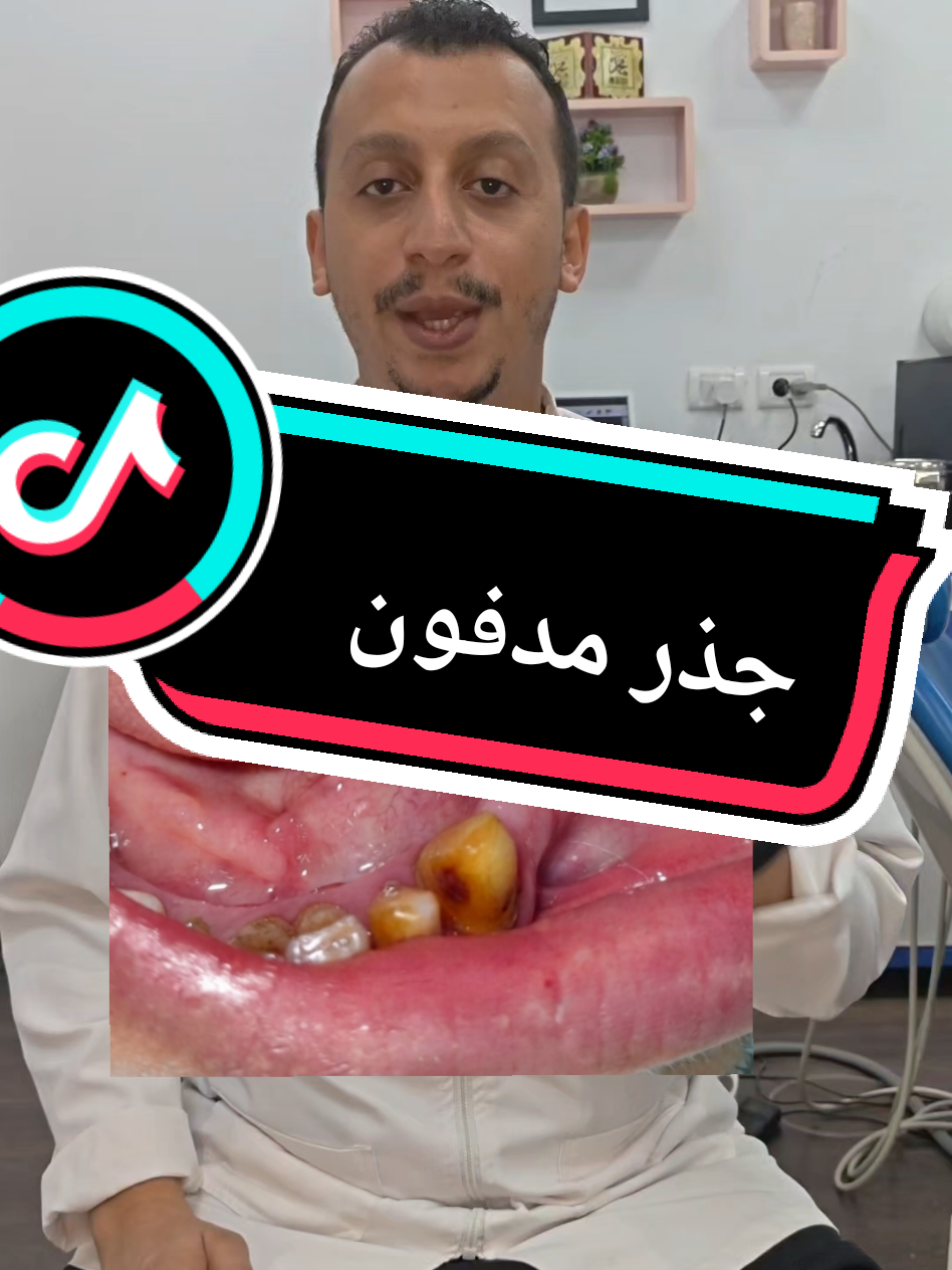 @Dr Ahmed Fattouh