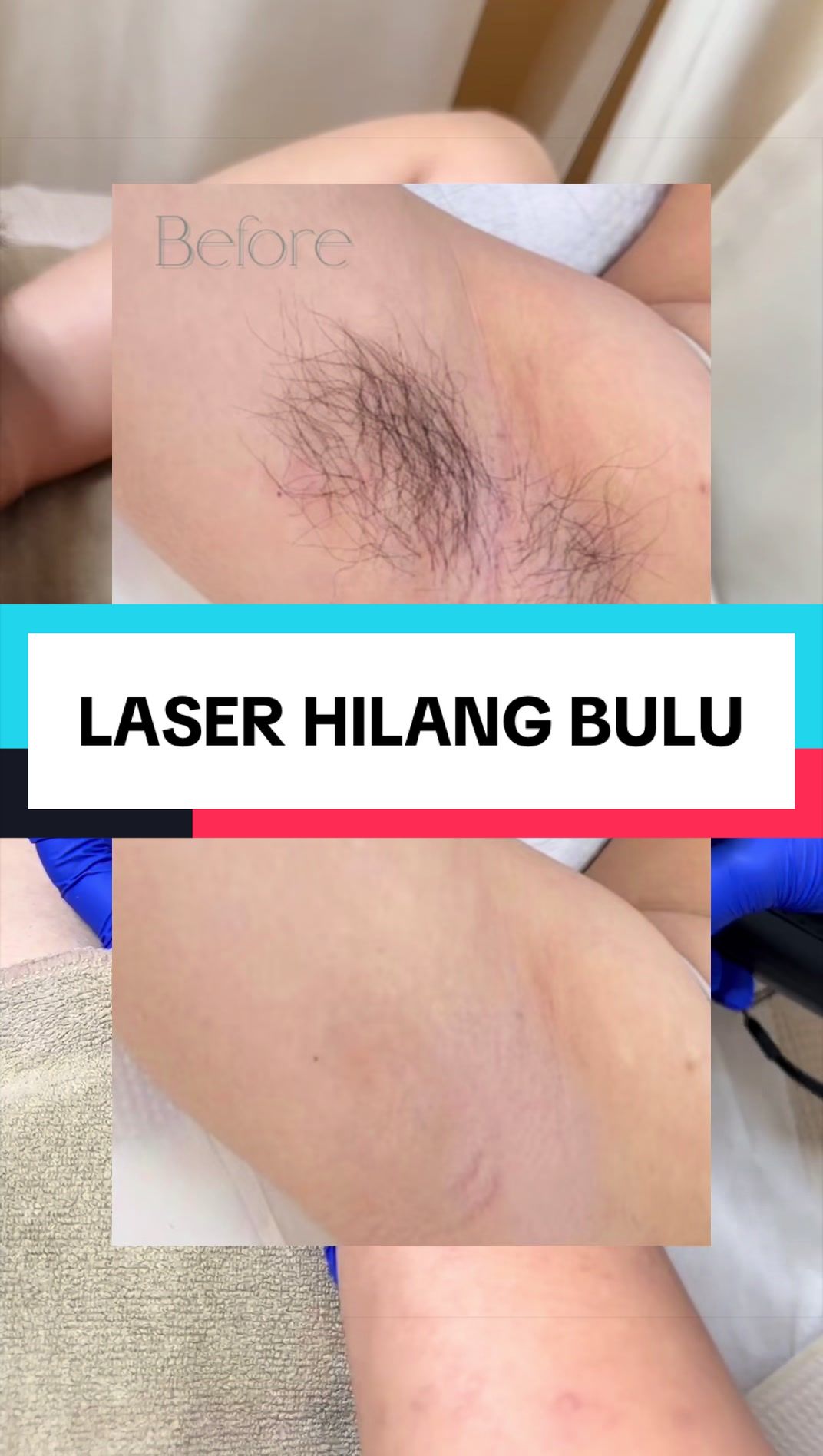 @MONA SKIN LASER & BEAUTY