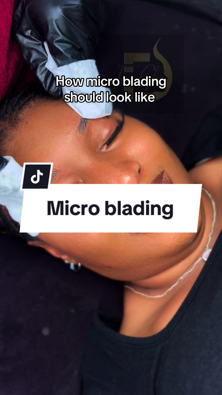@Frisglam