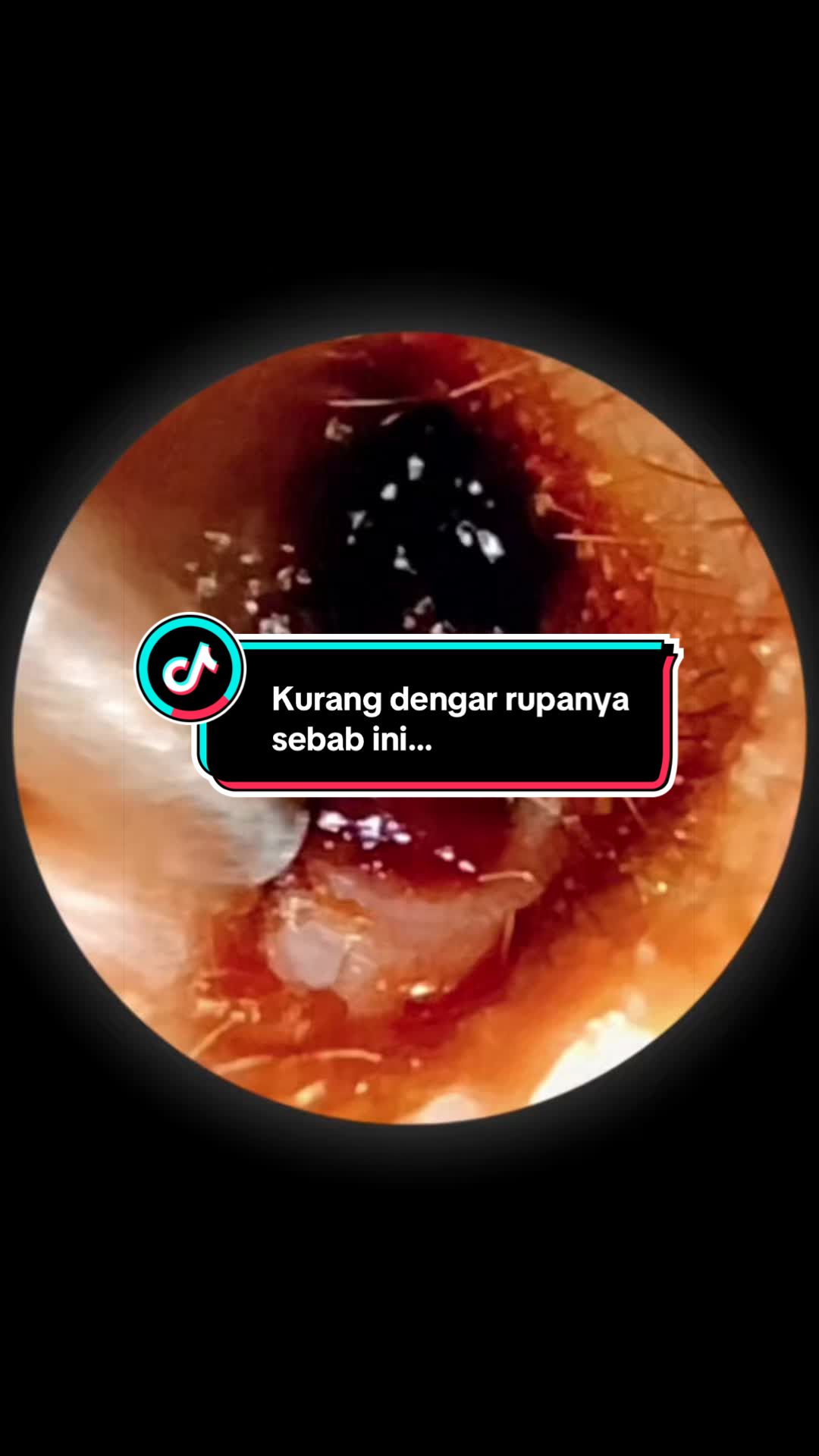 @Klinik Primer Cherang BP