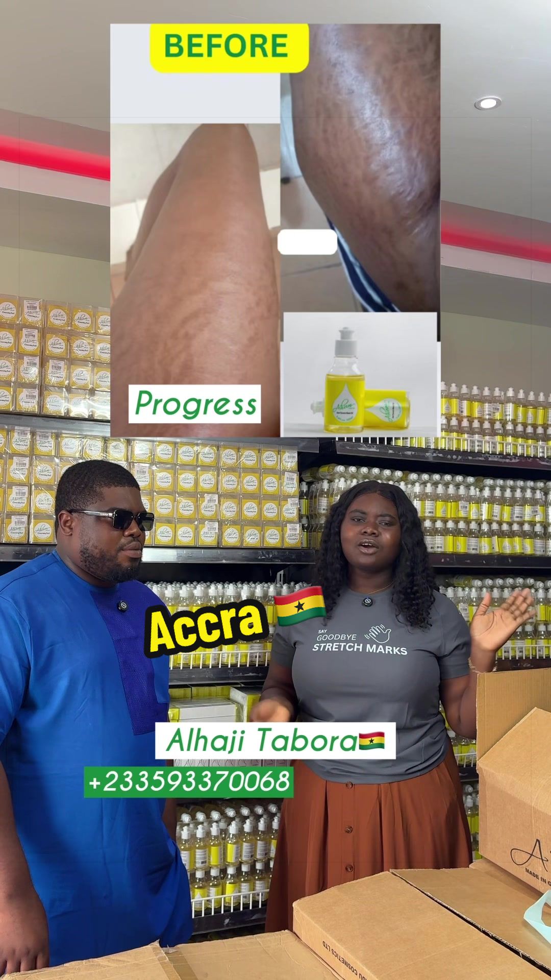 @No1 STRETCH MARKS PRODUCT