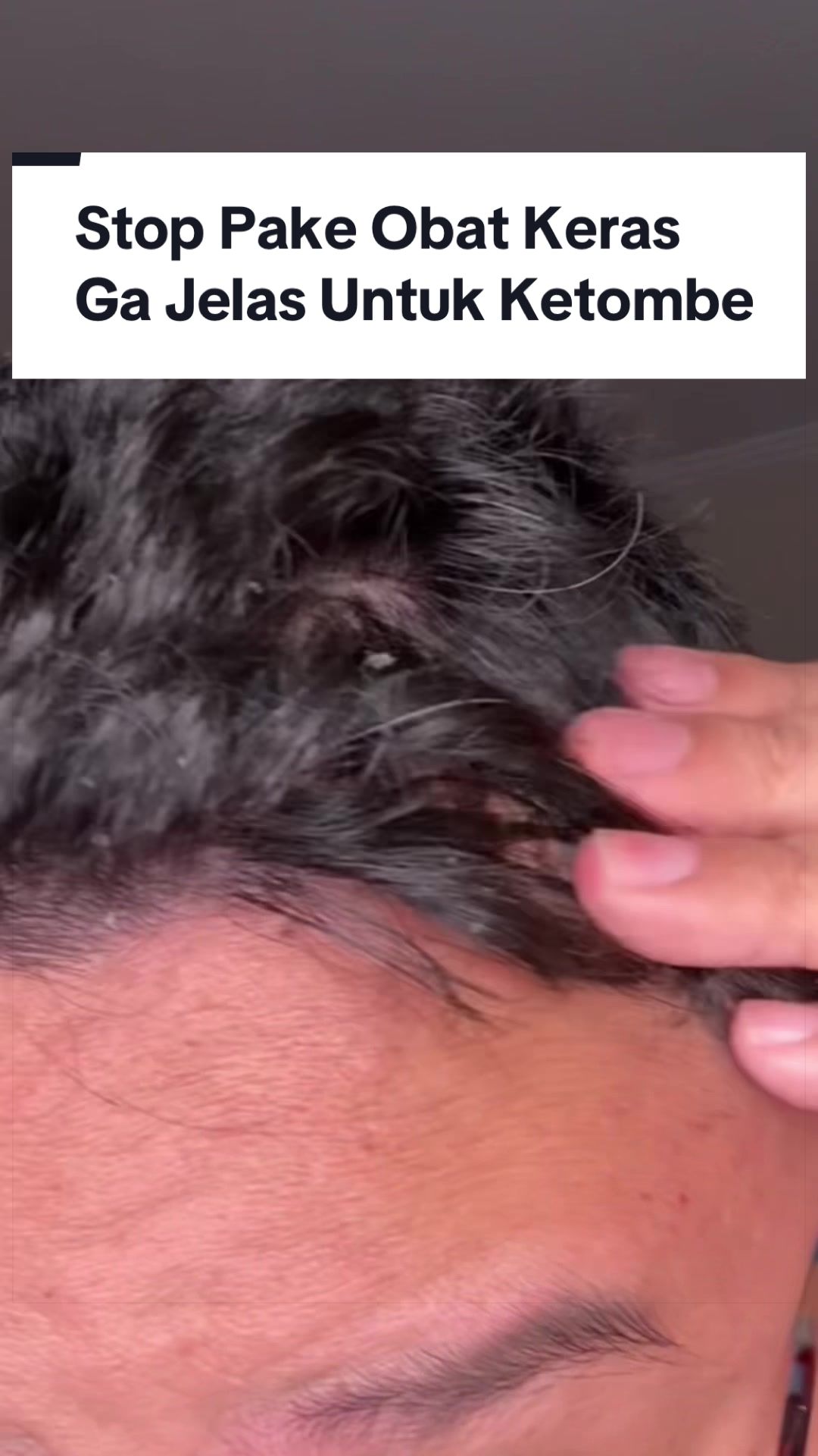@Ali | @HungryForSkincare