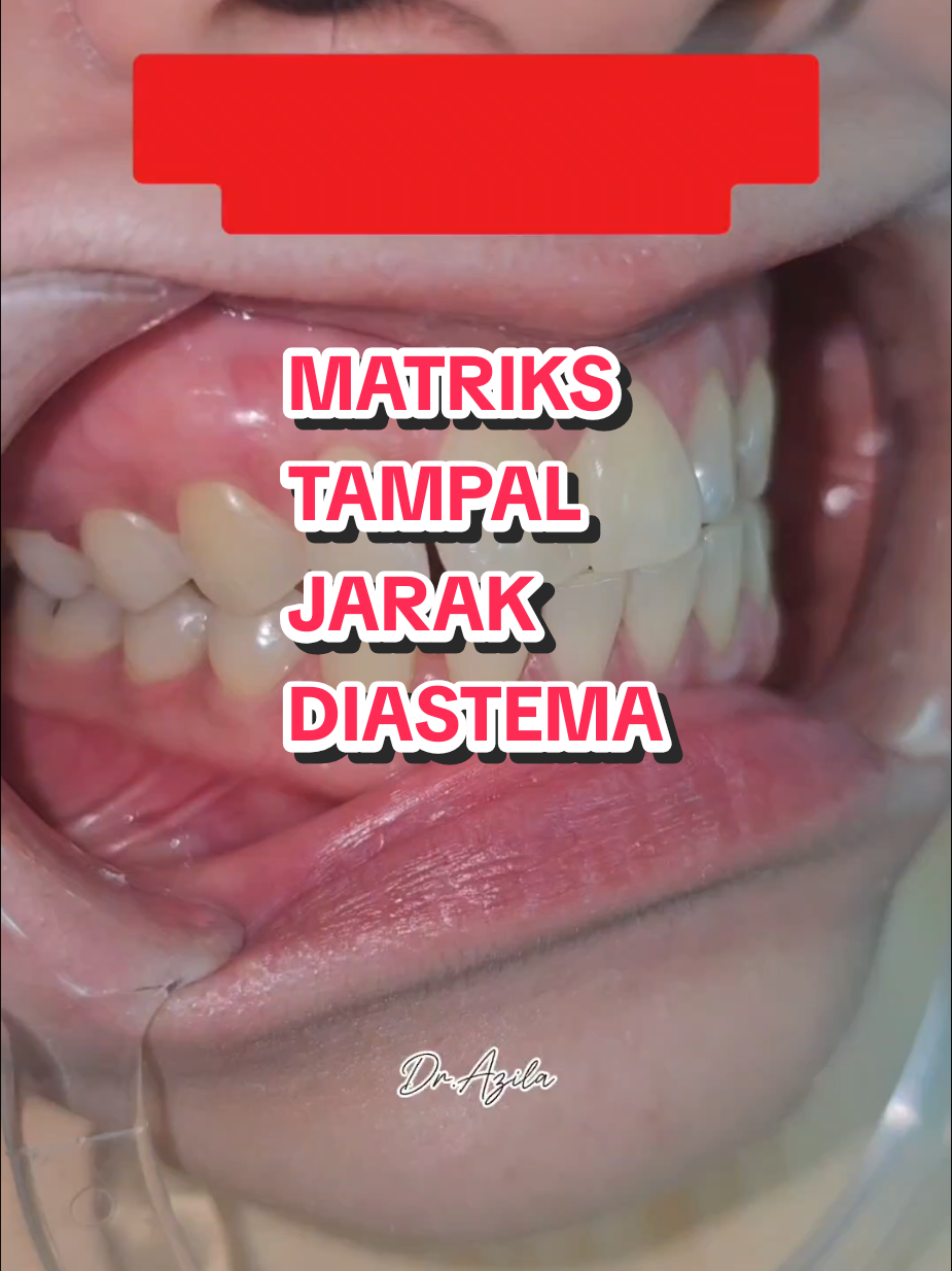@Dr. Azila