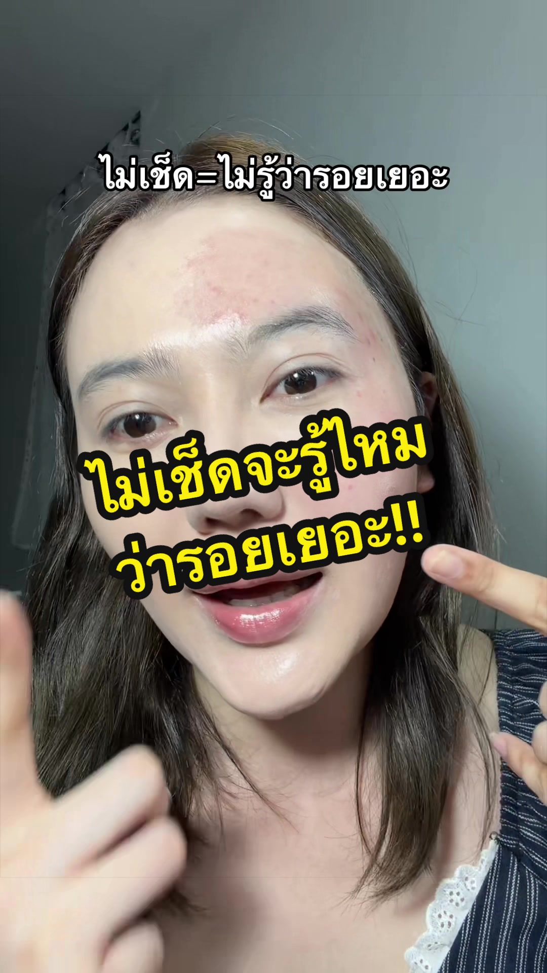 @แพร