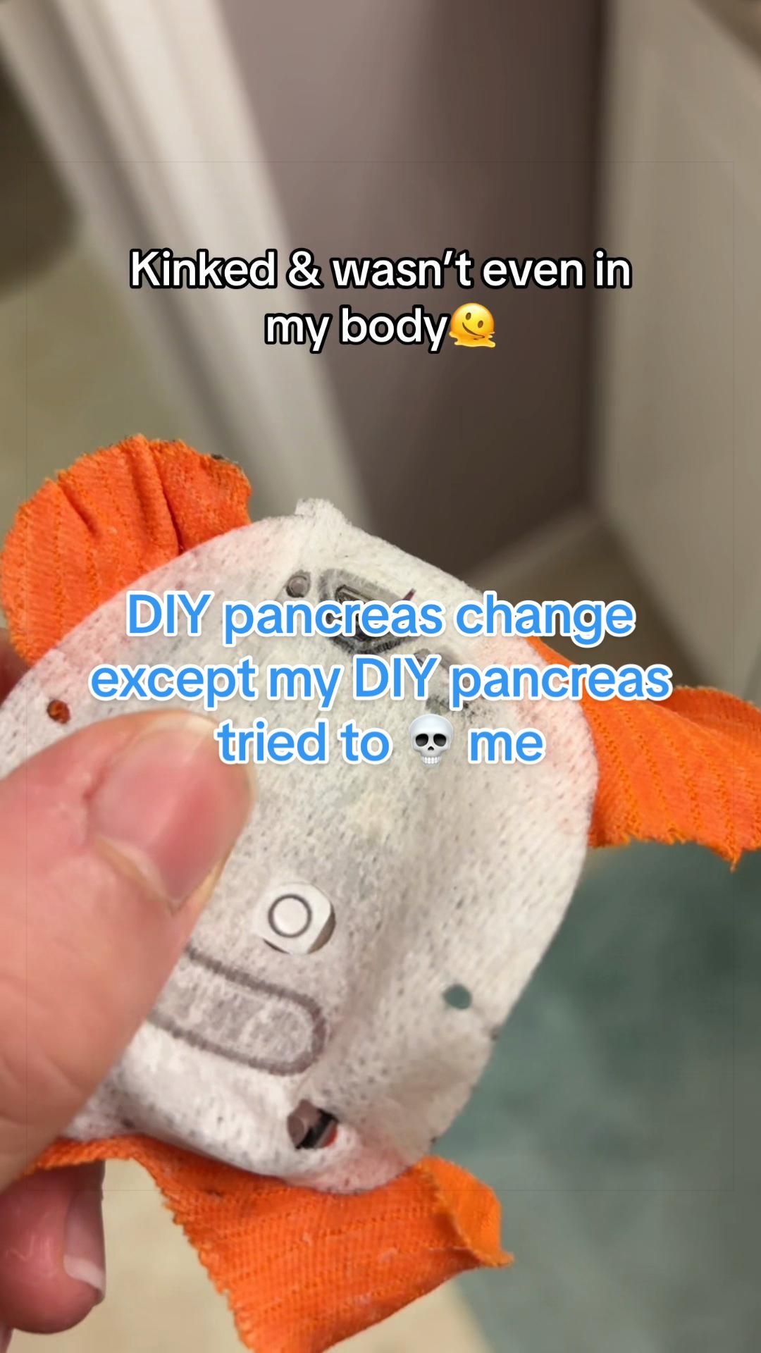 @TYPE 1 DEEABETES