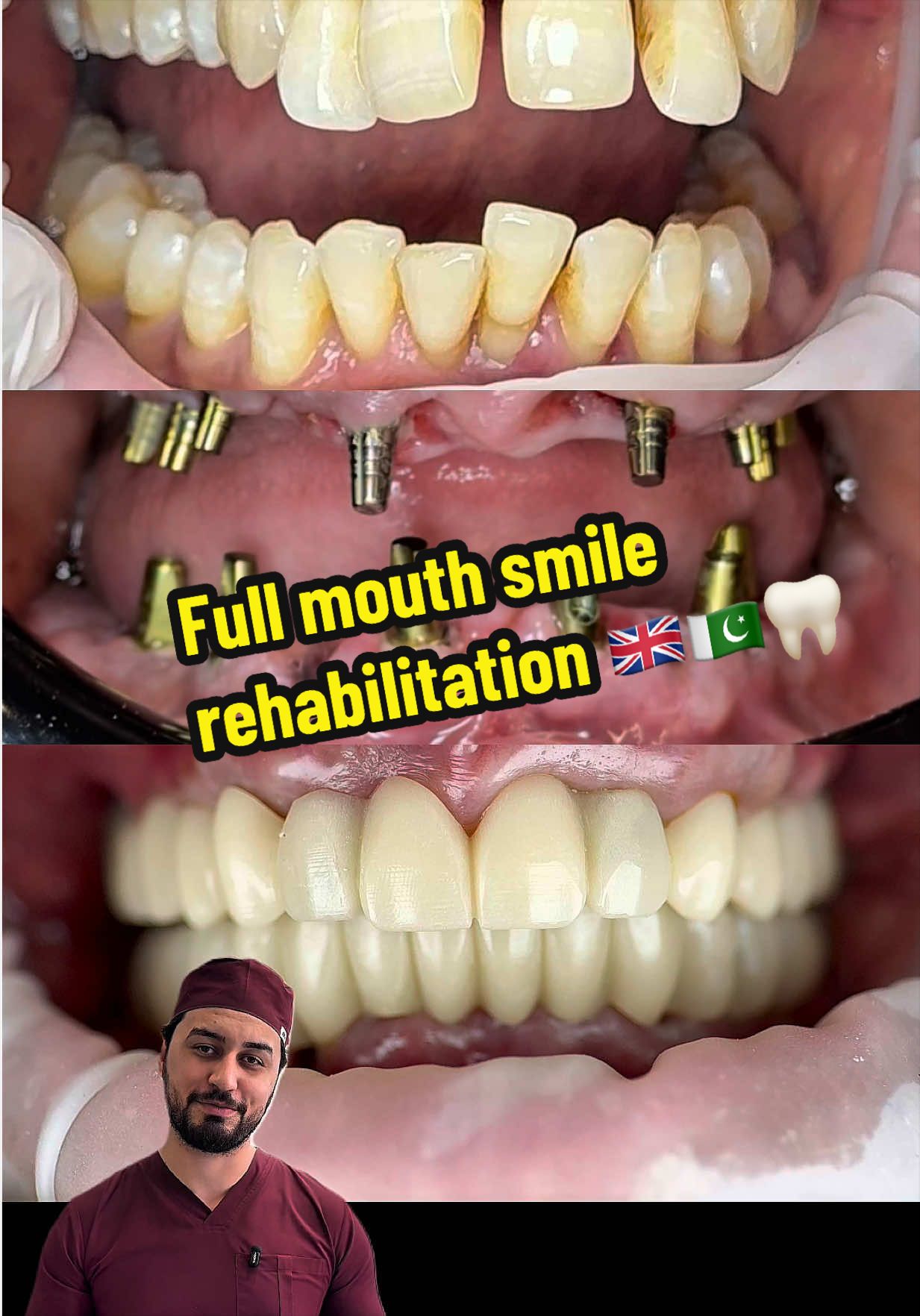 @Dr Haroon Shah