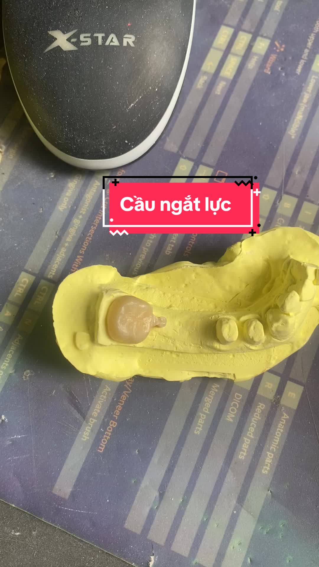 @Hùng răng sứ 🦷🦷